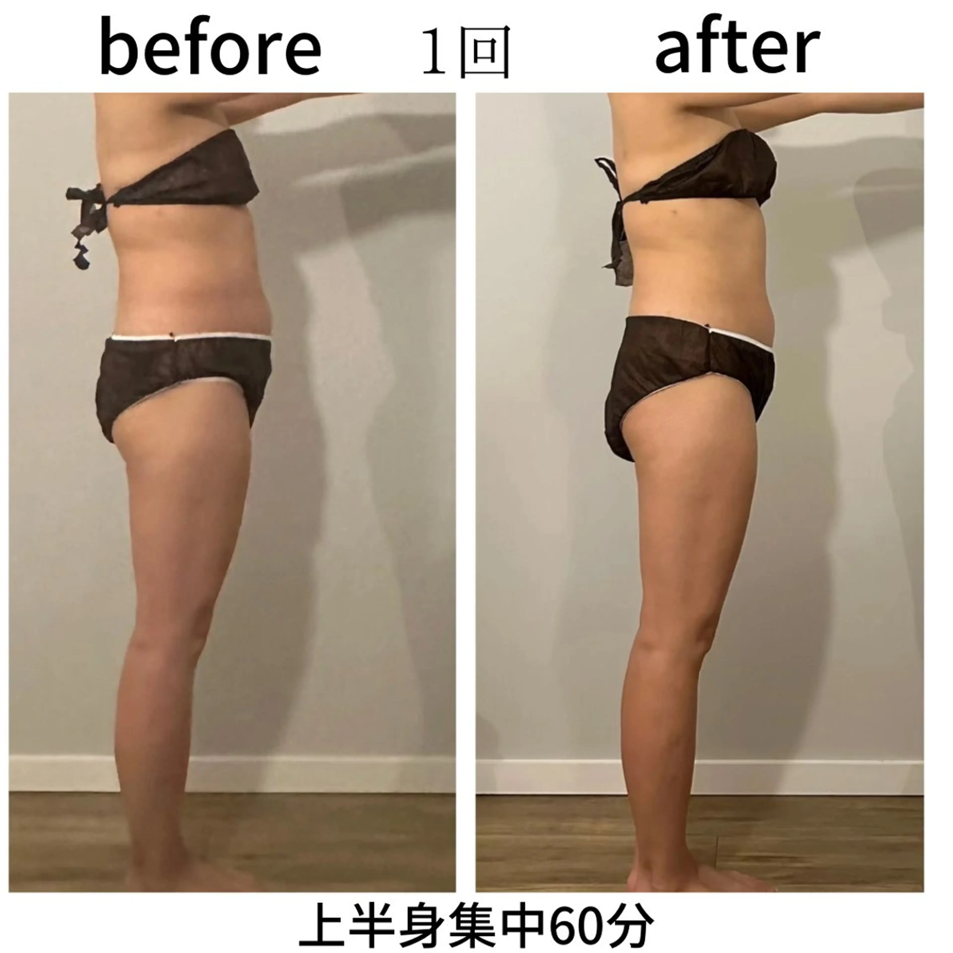 小顔・痩身専門店 Sunao所属・小顔.足痩せ整体 痩身天六Sunaoのその他イメージ