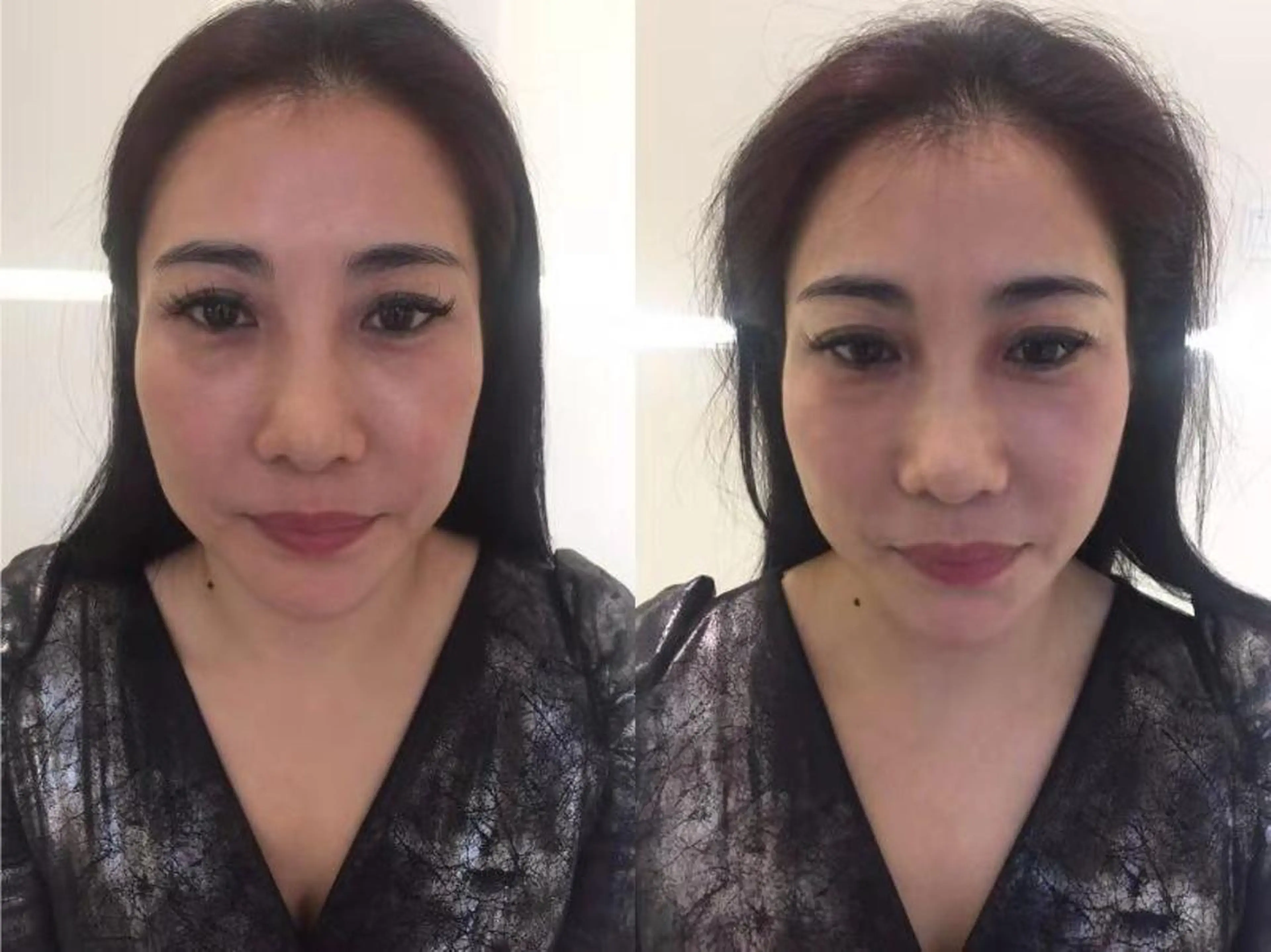 小顔矯正/美容整体 /骨盤矯正✨+Mi2のエステ・リラクイメージ