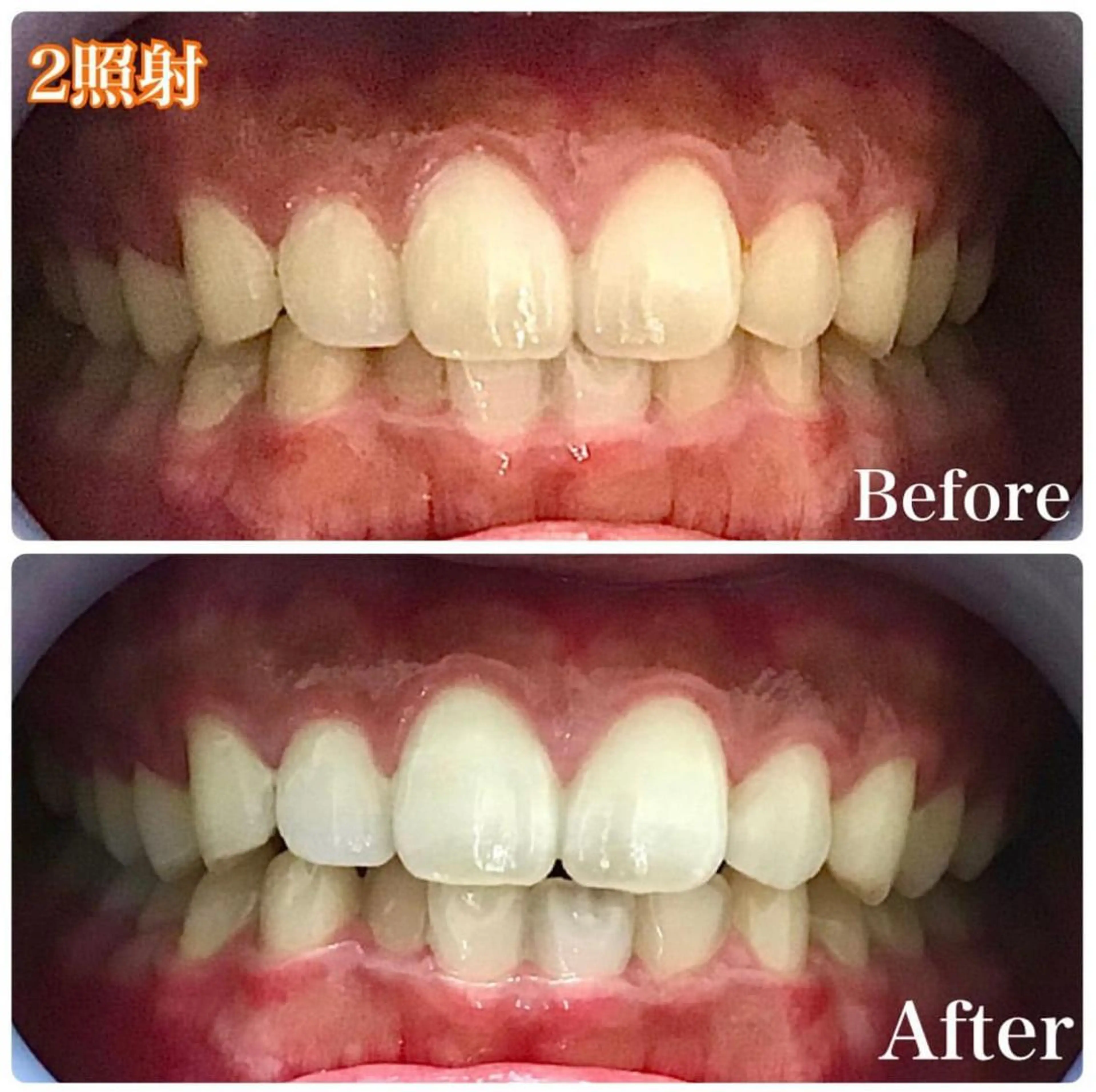 LOVE ホワイトニング渋谷のその他イメージ