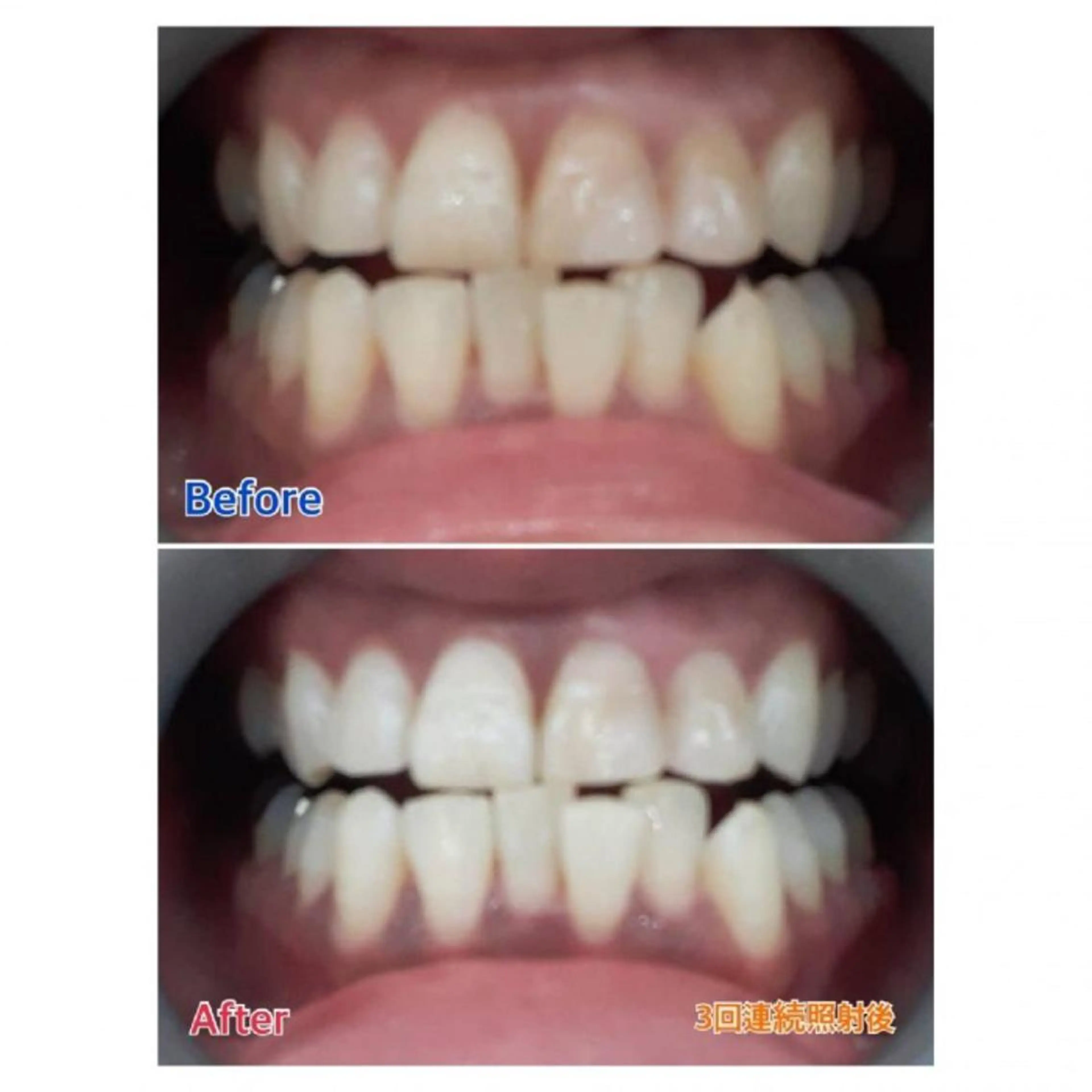 M渋谷店所属・Ｍ渋谷 ホワイトニングのエステ・リラクイメージ