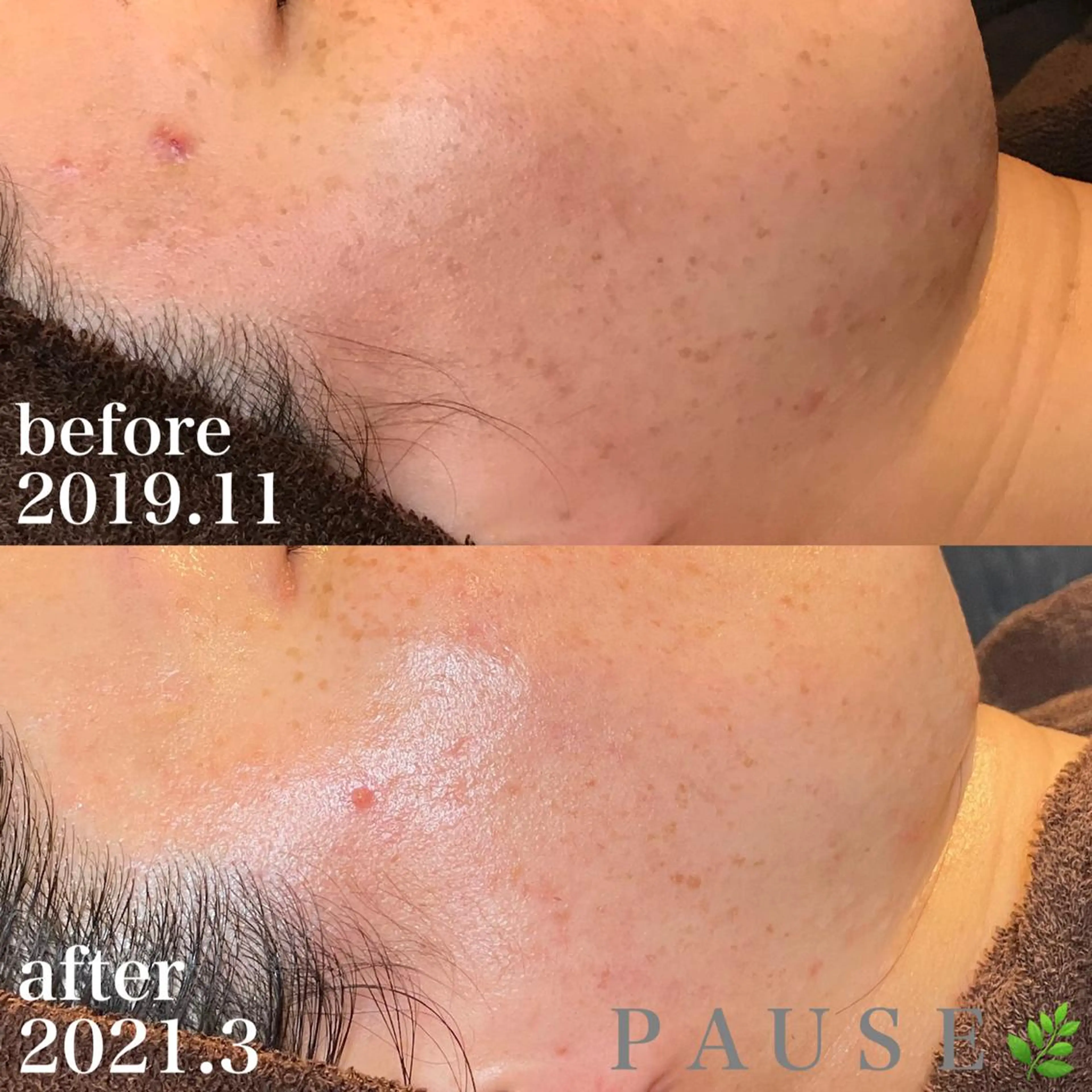 エステ 浜野 恵美のエステ・リラクイメージ