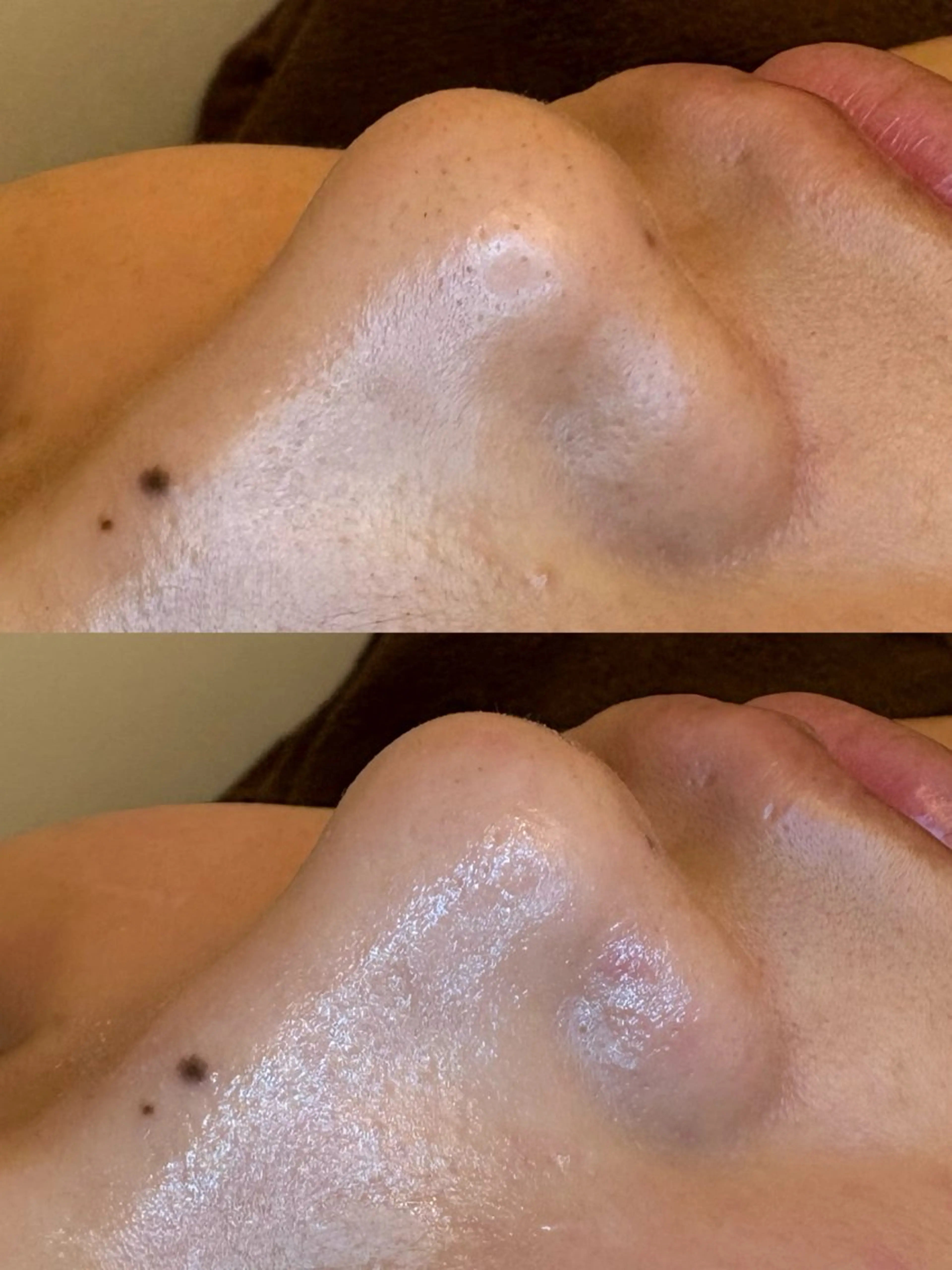 エステ EARTH coiffure beaute 新潟紫竹山店所属・🤍アベシュリ /フェイシャル🤍のエステ・リラクイメージ