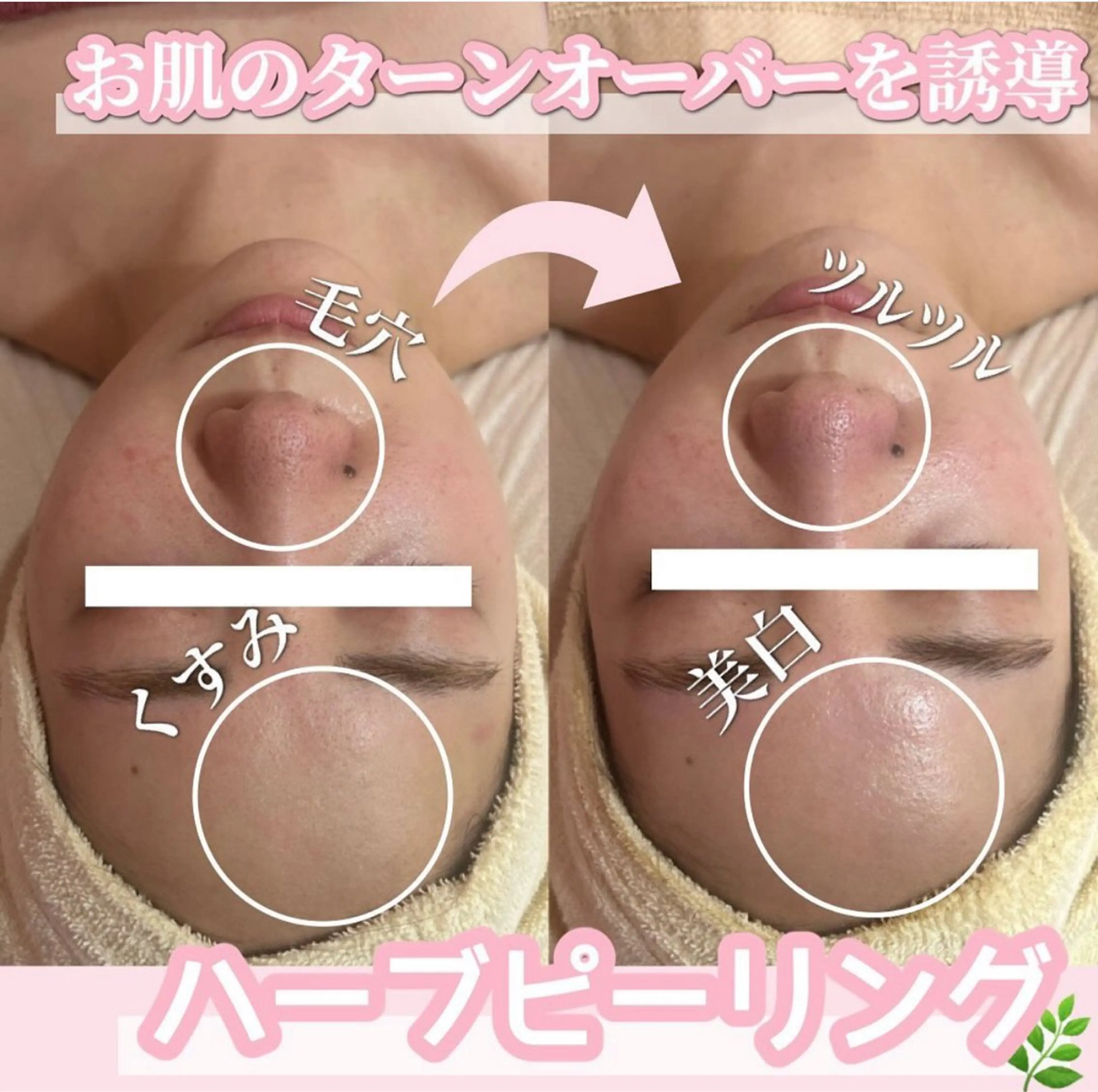 エステ SALON所属・SALON韓国肌管理 東別院のエステ・リラクイメージ