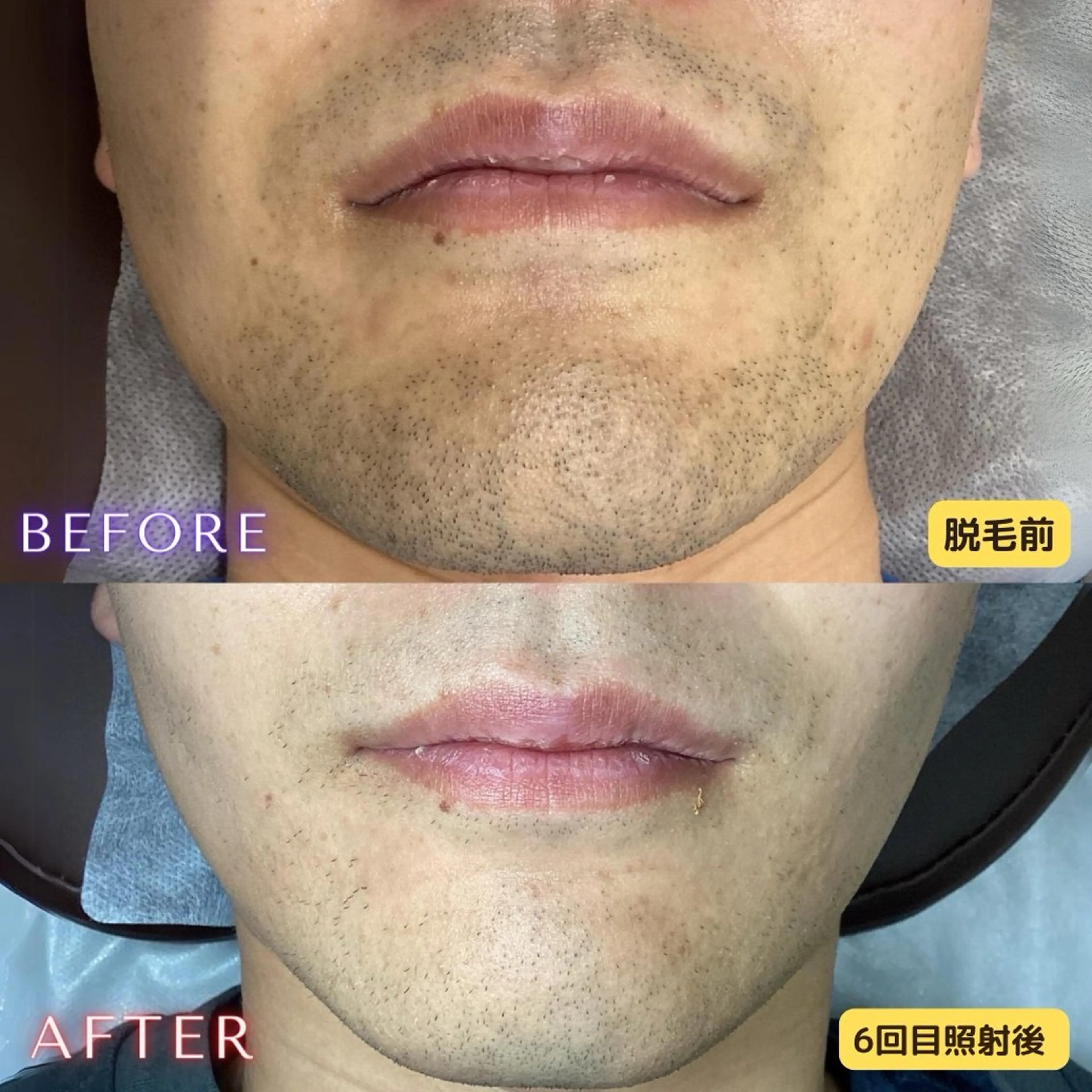 メンズ 脱毛 都度払い専門 脱毛サロンHYGIENE BEAUTY ROOM 19B 仙台駅前東口店所属・脱毛サロン 19B(毛利)のエステ・リラクイメージ