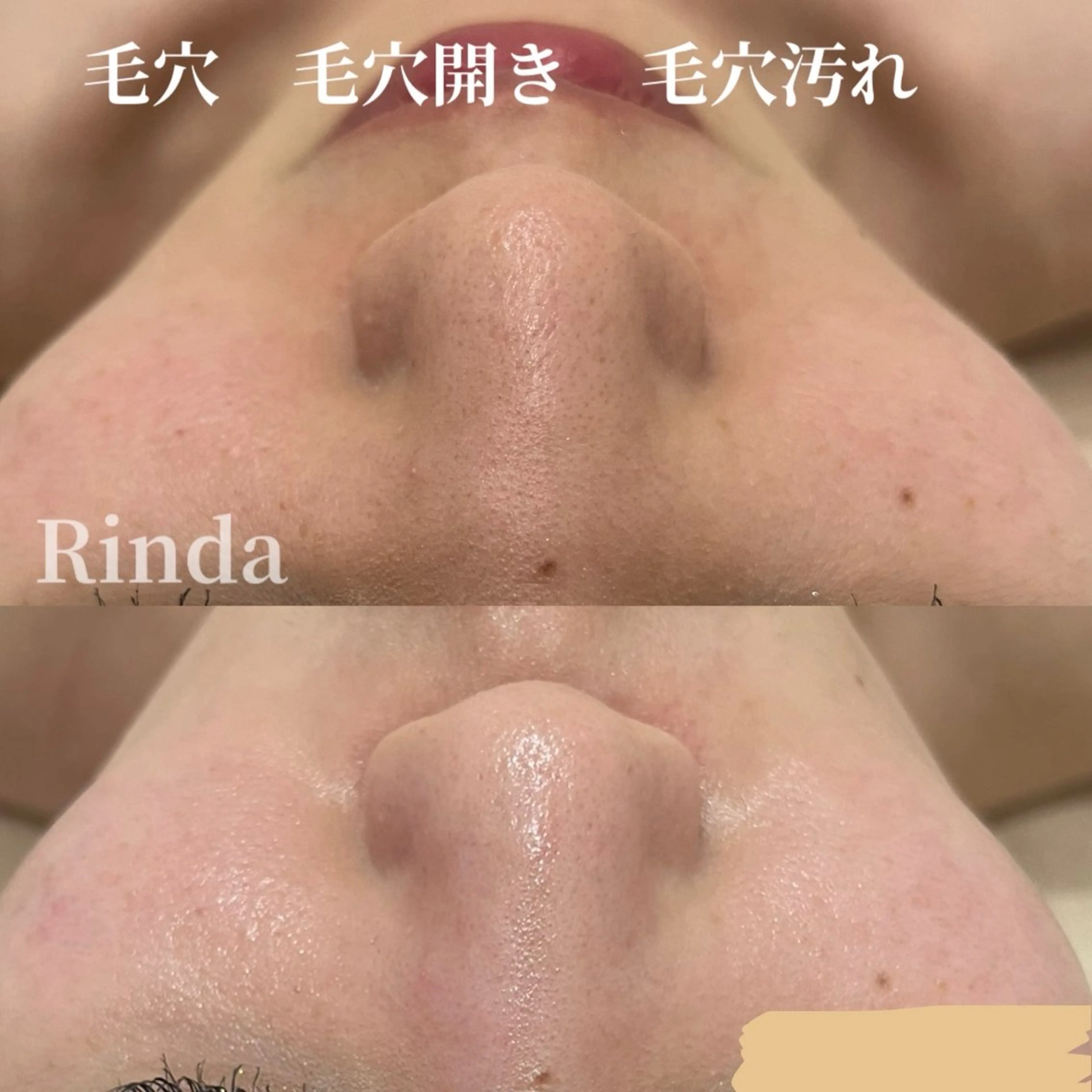 エステ ブライダル痩身×脱毛 尼崎駅前サロンのエステ・リラクイメージ