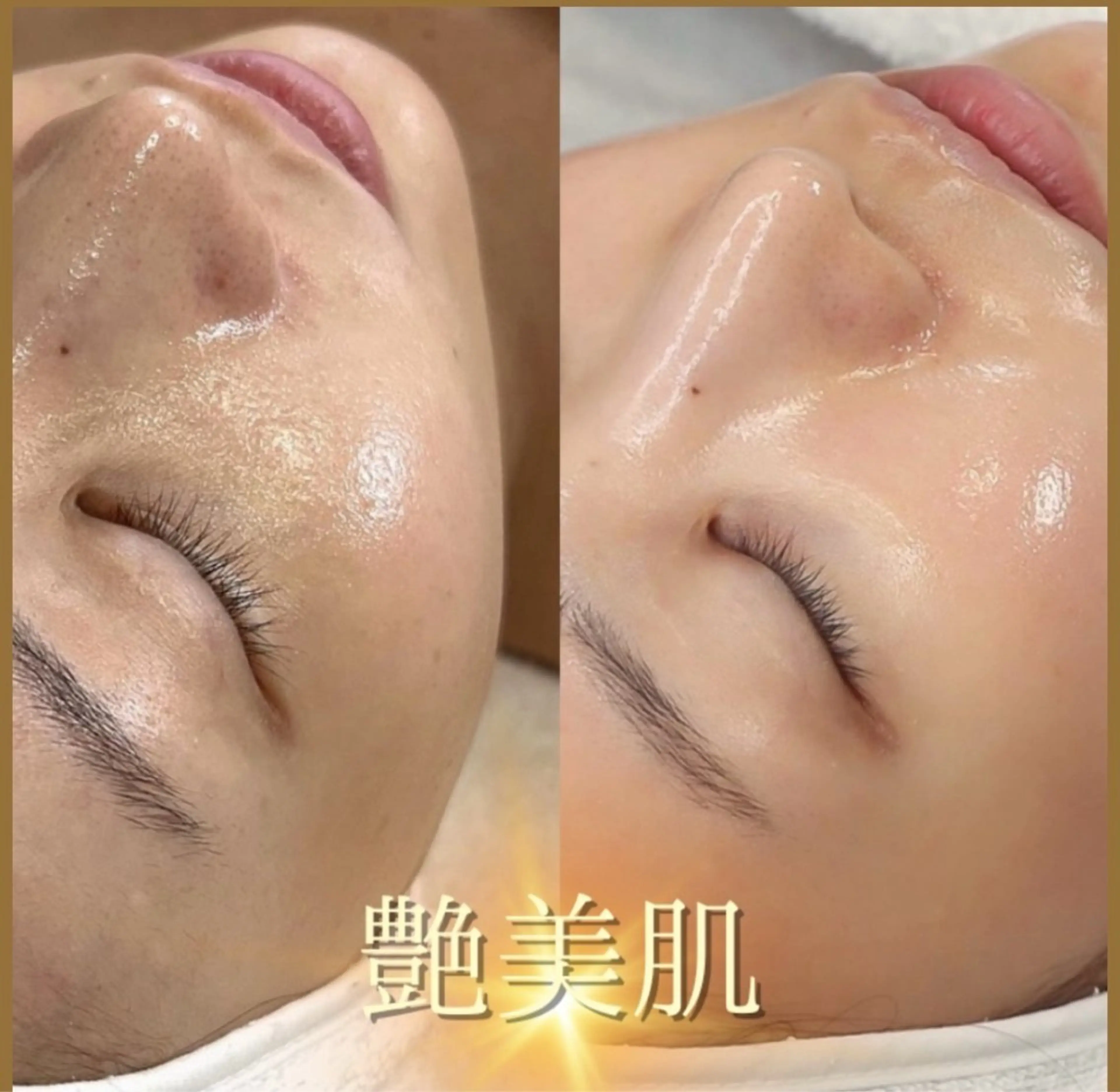 \韓国発！🇰🇷艶肌美容/スキングロウトリートメント💕初回限定価格でご案内中✨の写真