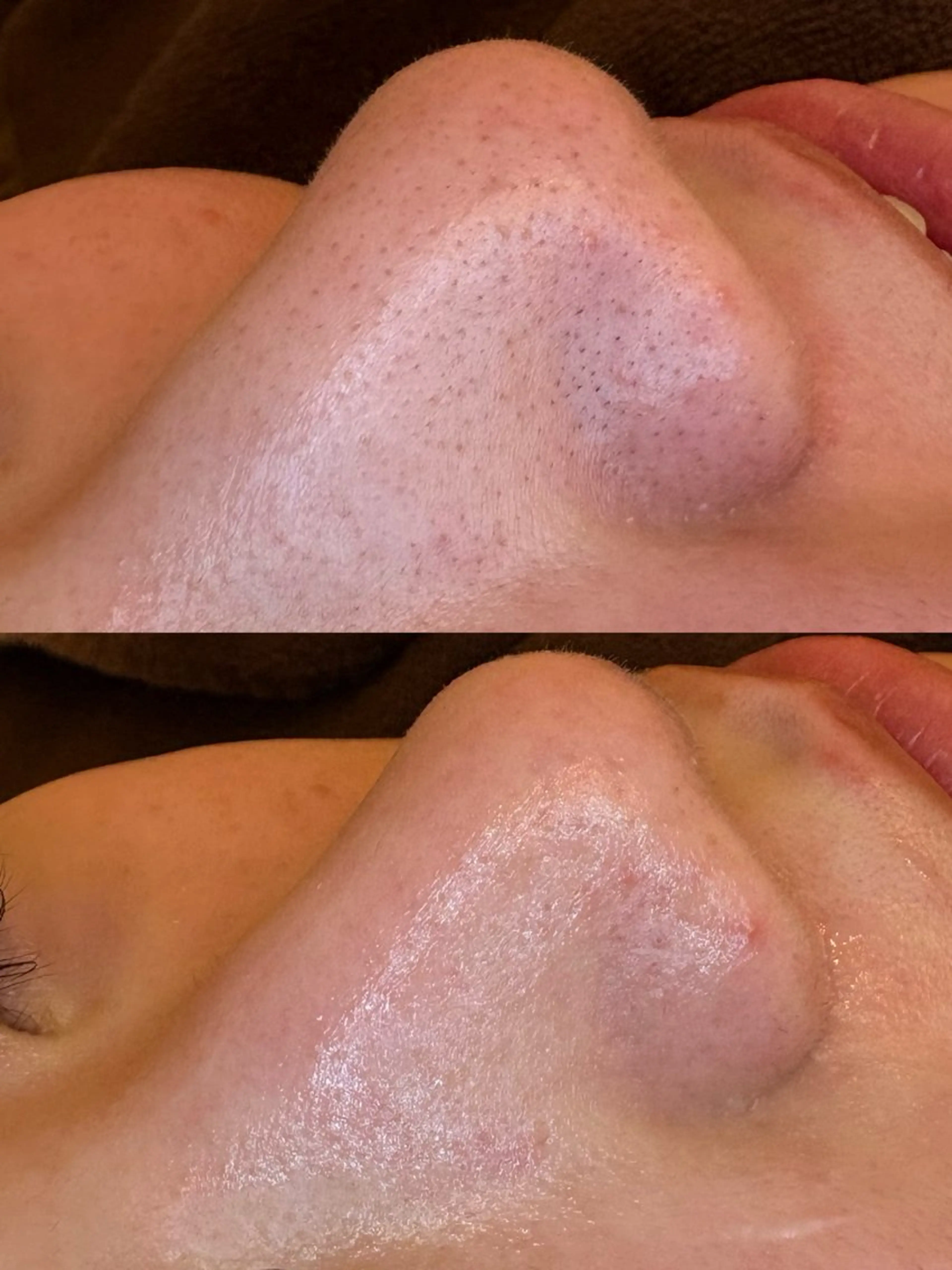 エステ EARTH coiffure beaute 新潟紫竹山店所属・🤍アベシュリ /フェイシャル🤍のエステ・リラクイメージ