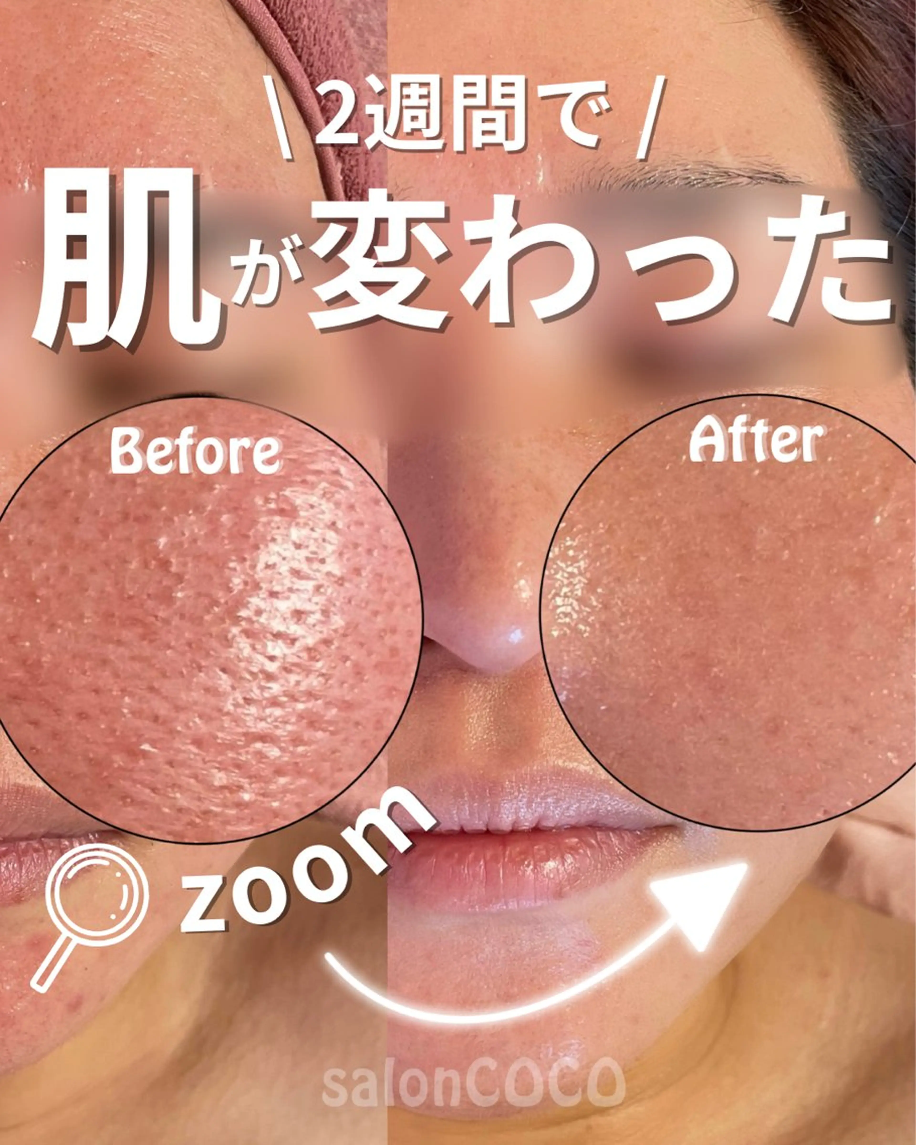 エステ リラク salonCOCO所属・素肌再建看護師💎 salonCOCOのエステ・リラクイメージ