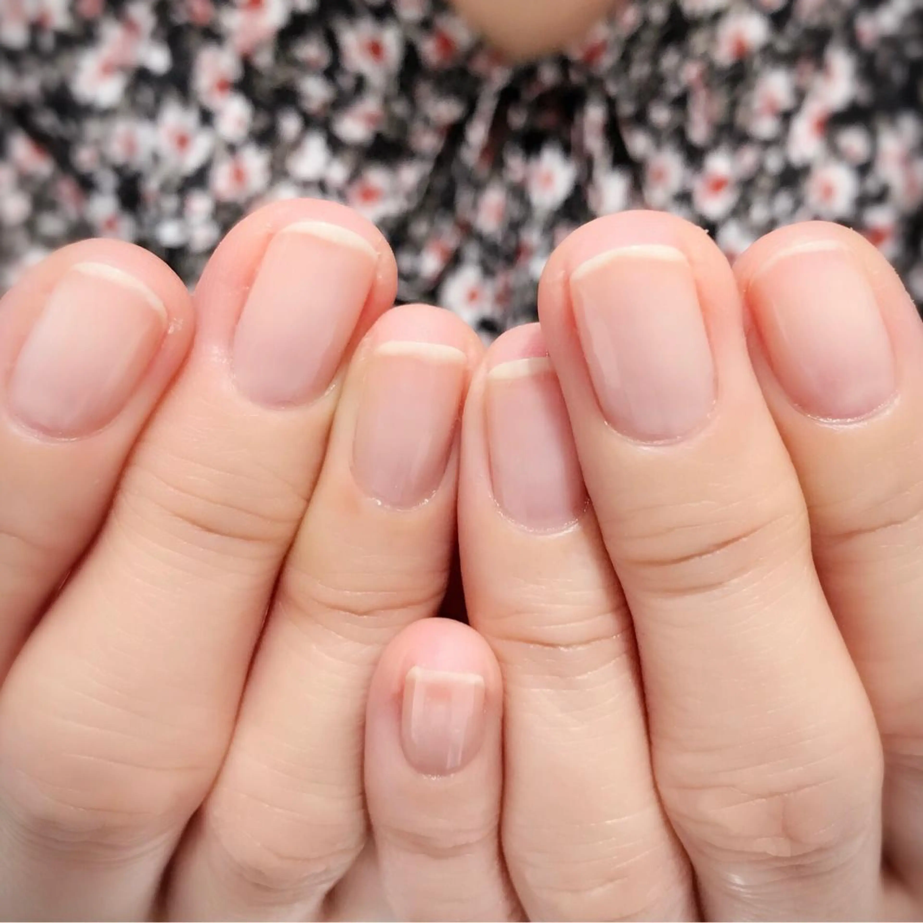 最強ネイルケアお試しの写真