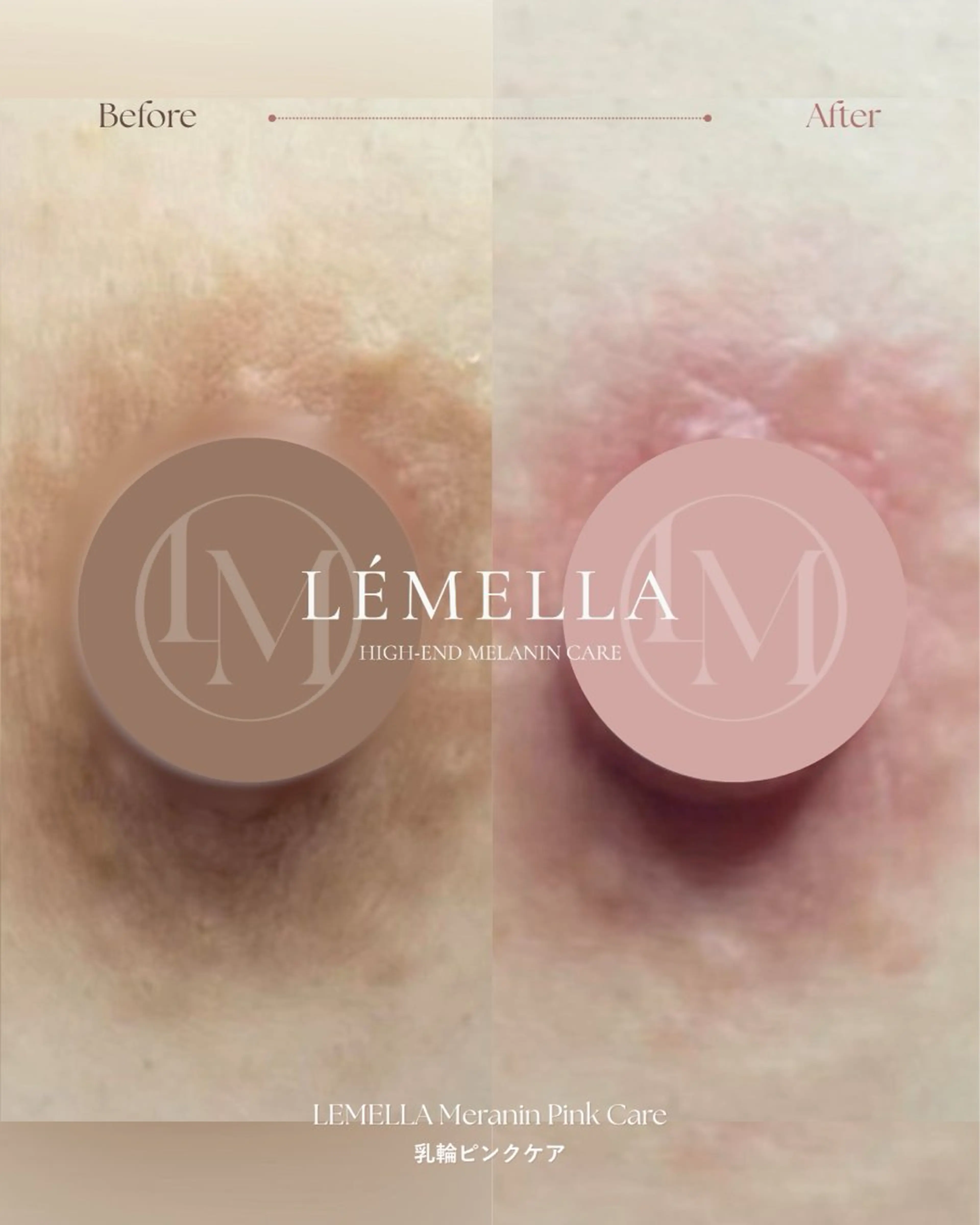 その他 Chel チェルのその他イメージ