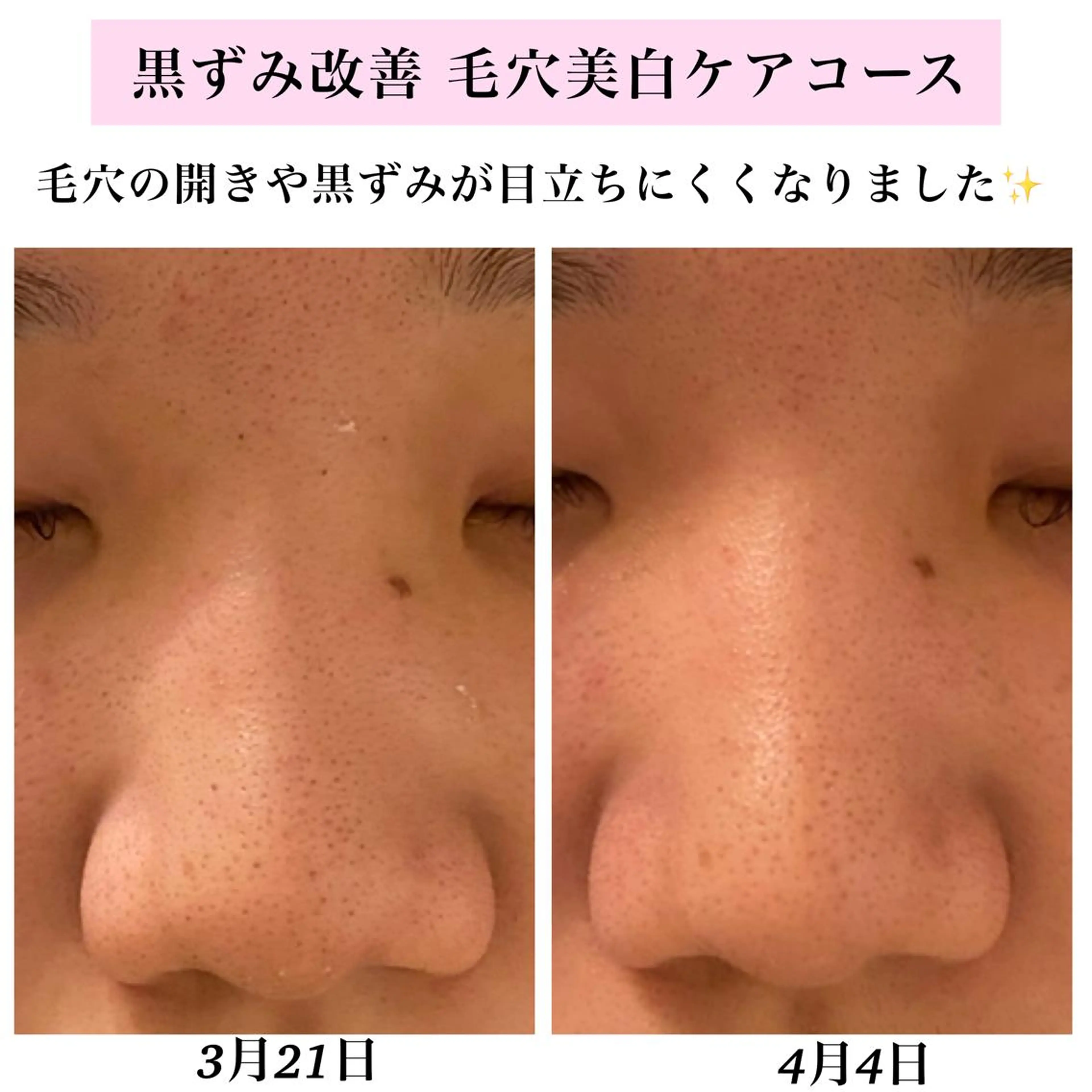 エステ リラク Bellesthe （ベルエステ）のエステ・リラクイメージ