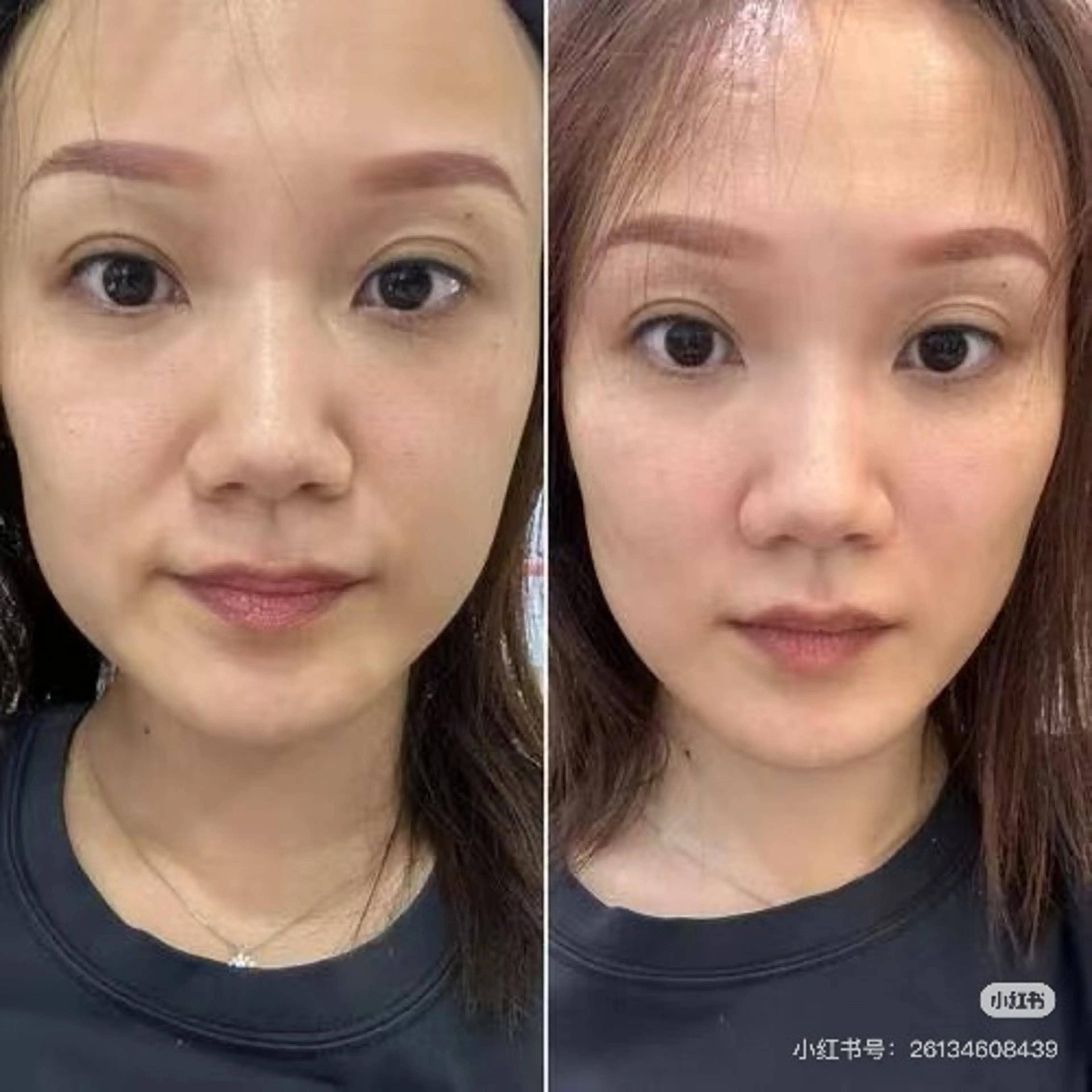 ネイル その他 aliaハイフ&水光ジェットサロン所属・aliaハーブ水光店 エステティシャン募集のエステ・リラクイメージ