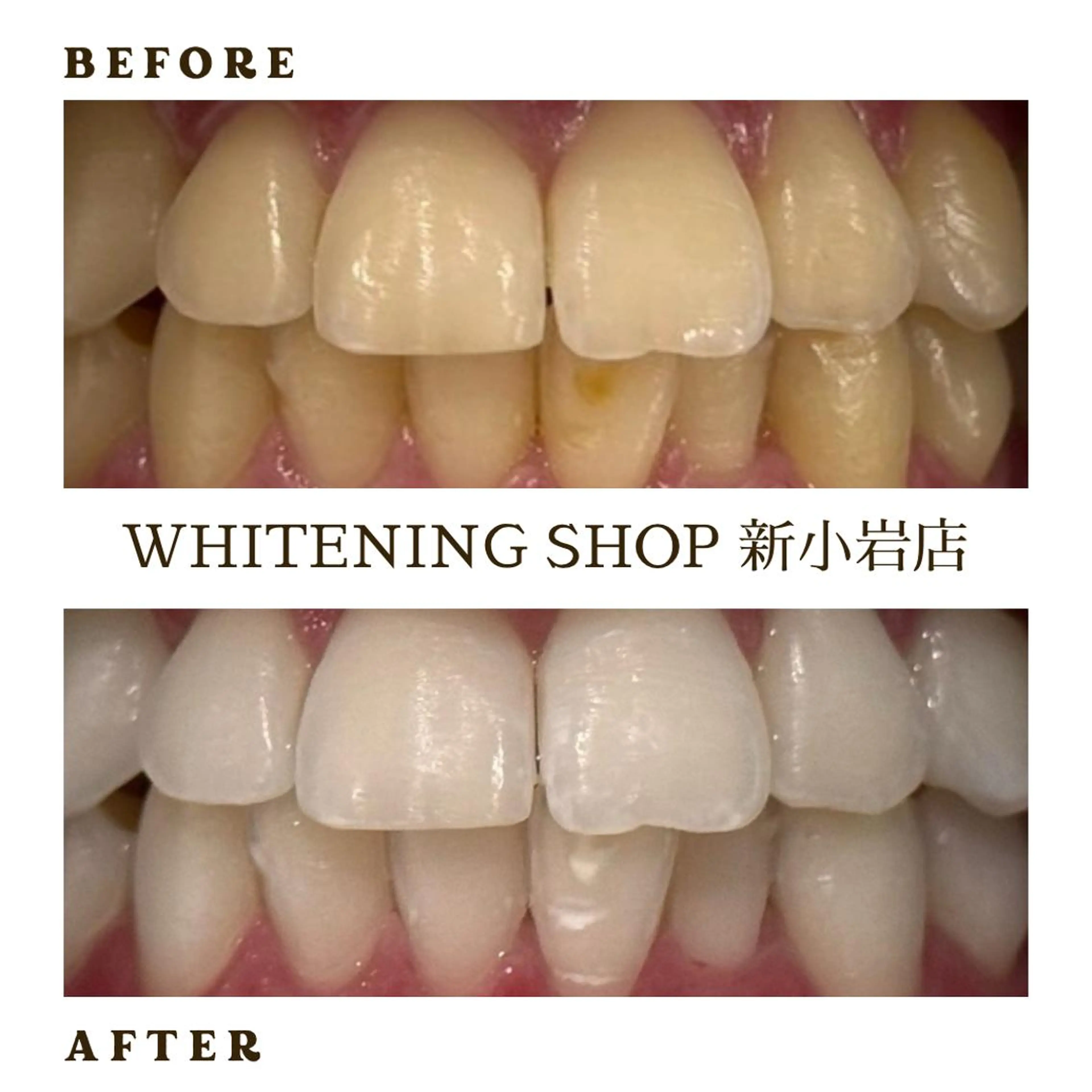 メンズ その他 ホワイトニング ショップ新小岩店のその他イメージ