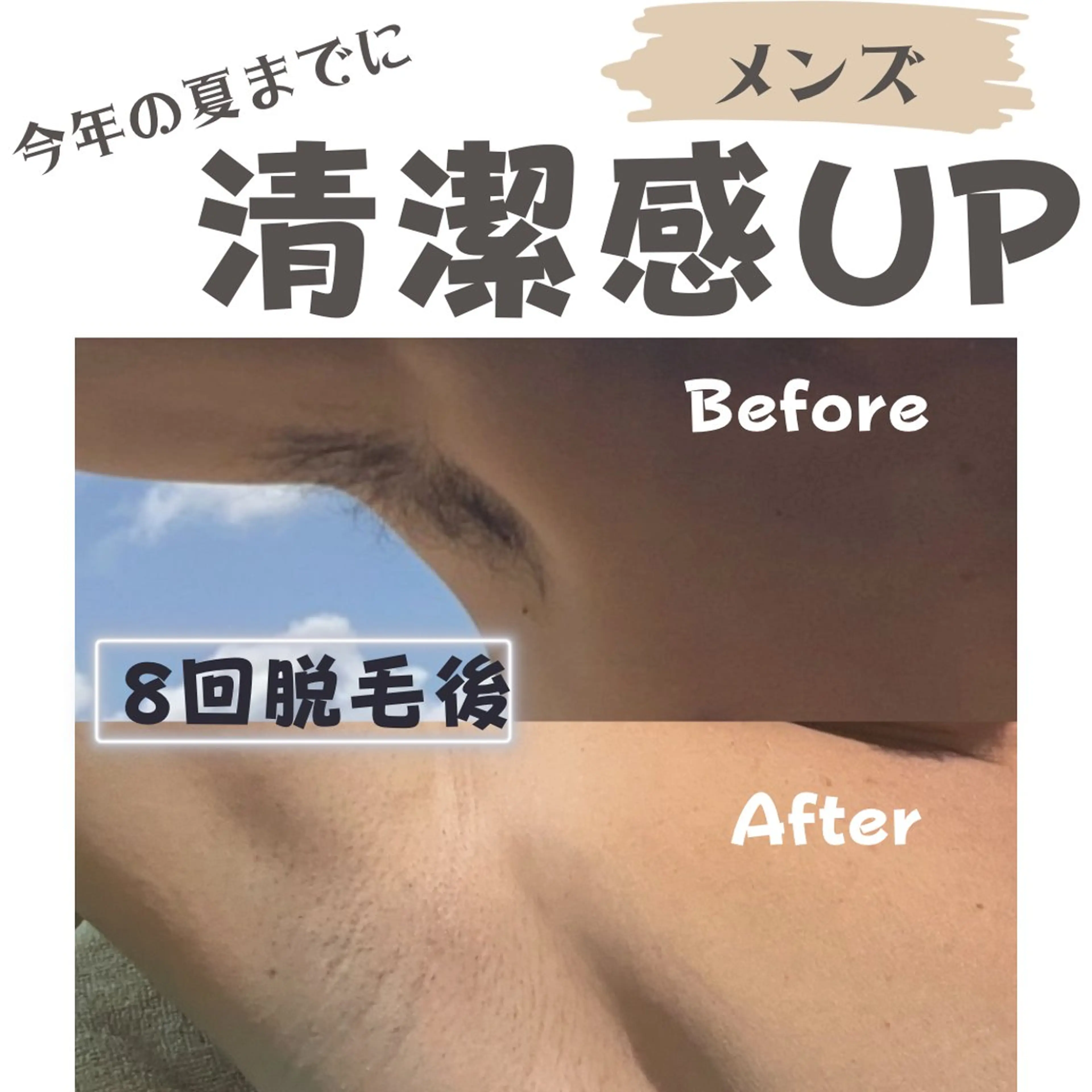 メンズ キッズ 脱毛サロン@M.Room by galbe所属・松や Roomのエステ・リラクイメージ