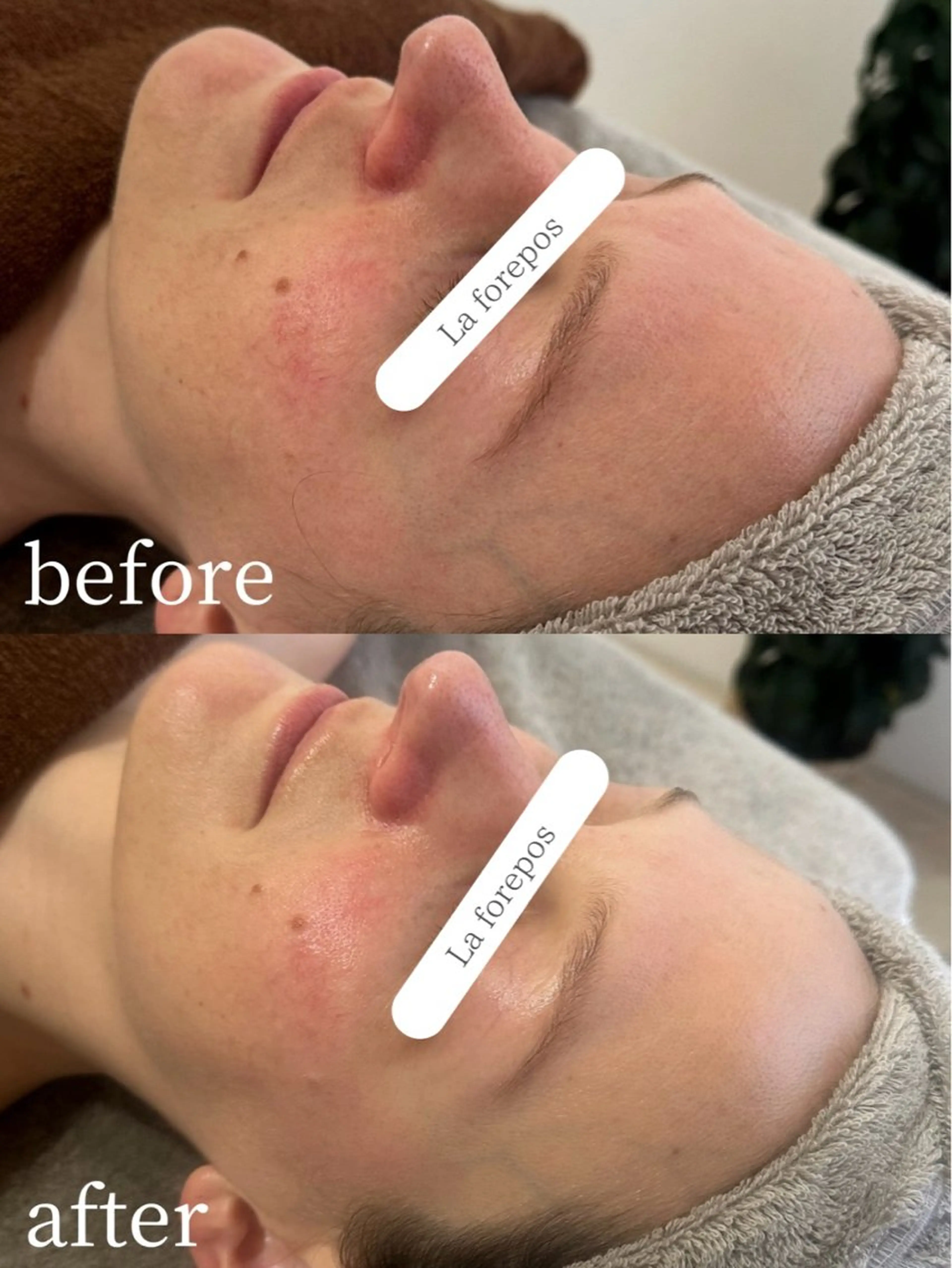 La forepos 恵比寿所属・La forepos フェイシャルエステのエステ・リラクイメージ