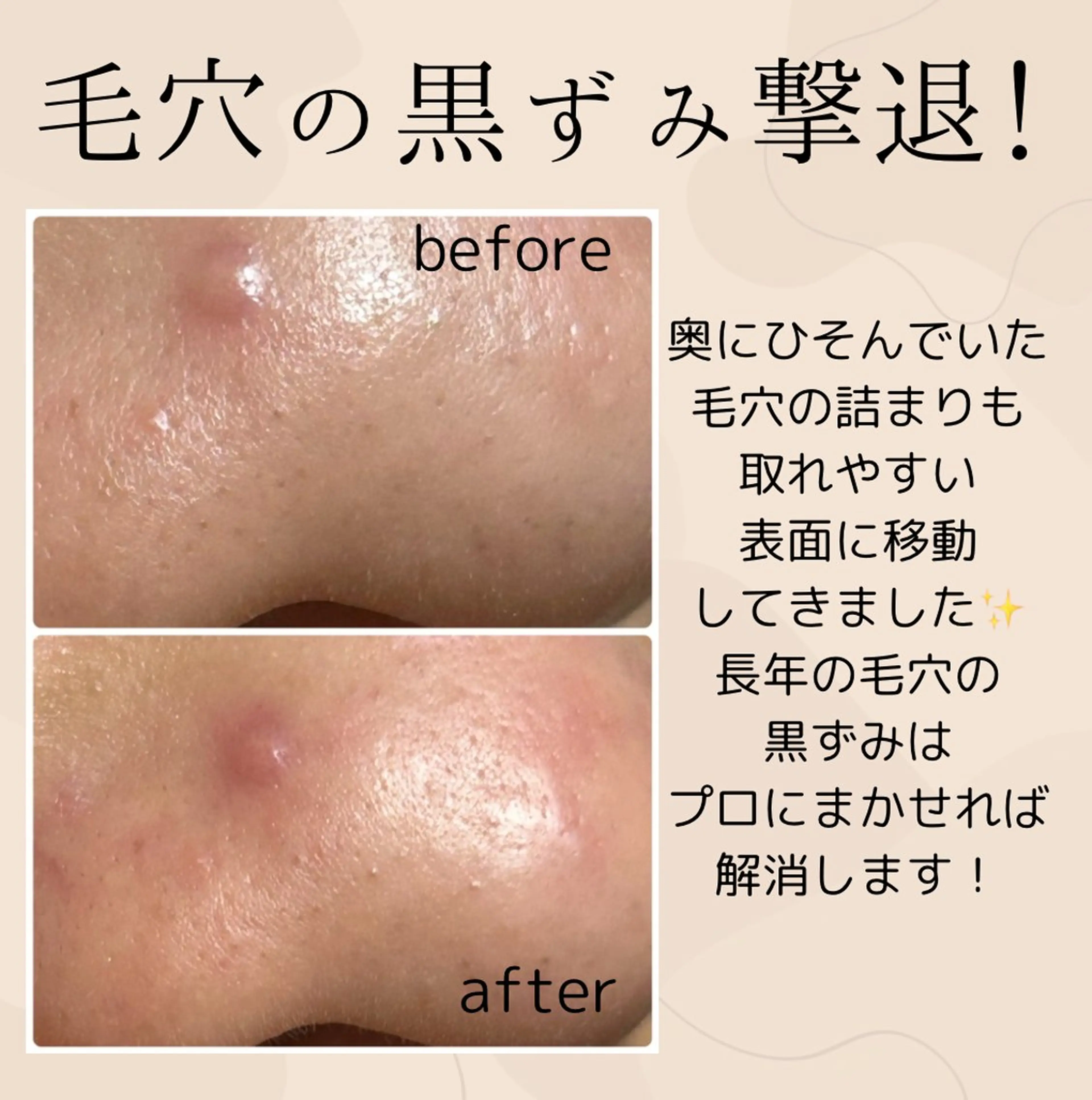 エステ 小顔・毛穴・たるみ ネイル　似内真樹のエステ・リラクイメージ