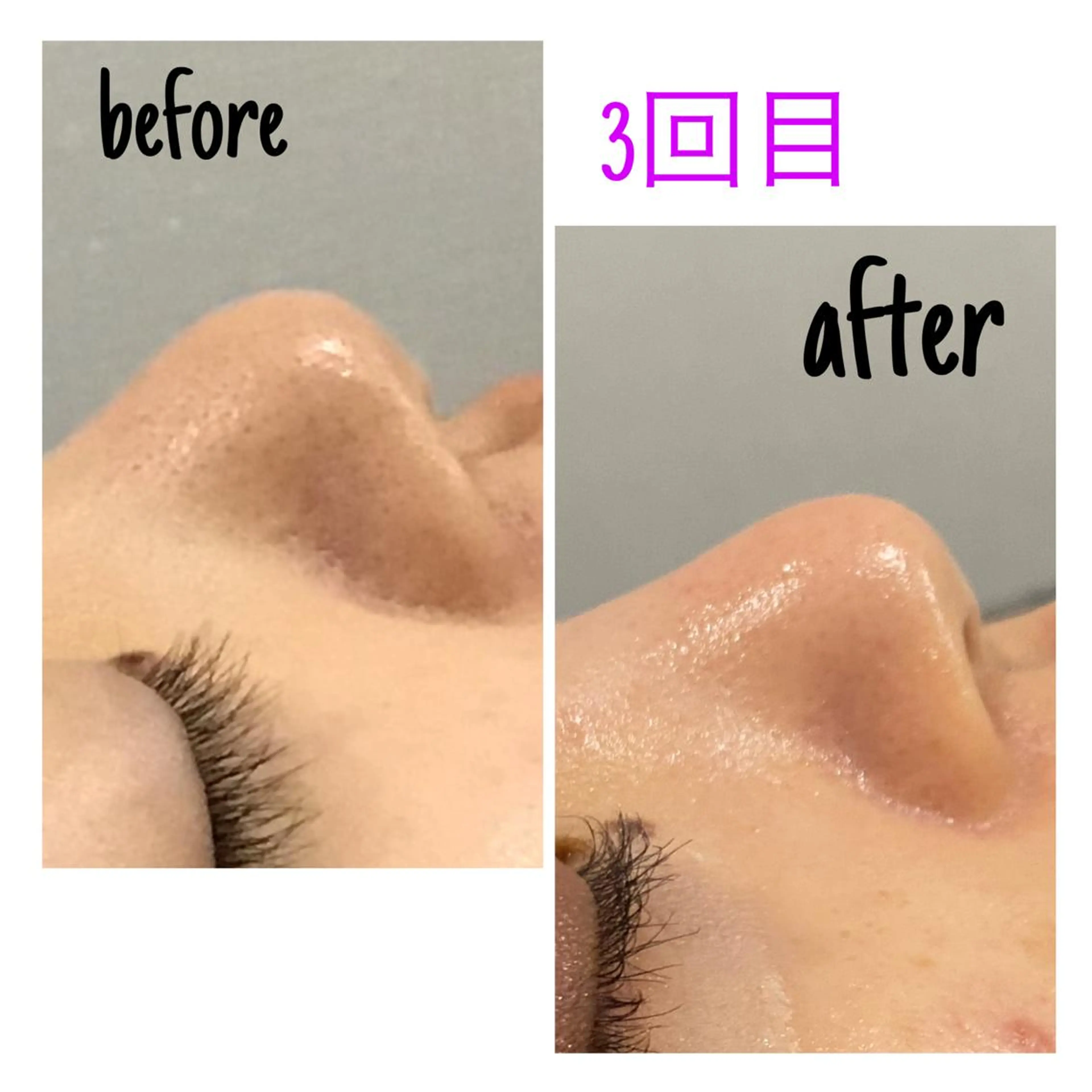 エステ 毛穴洗浄・痩身・脱毛 /アルカンジュのエステ・リラクイメージ