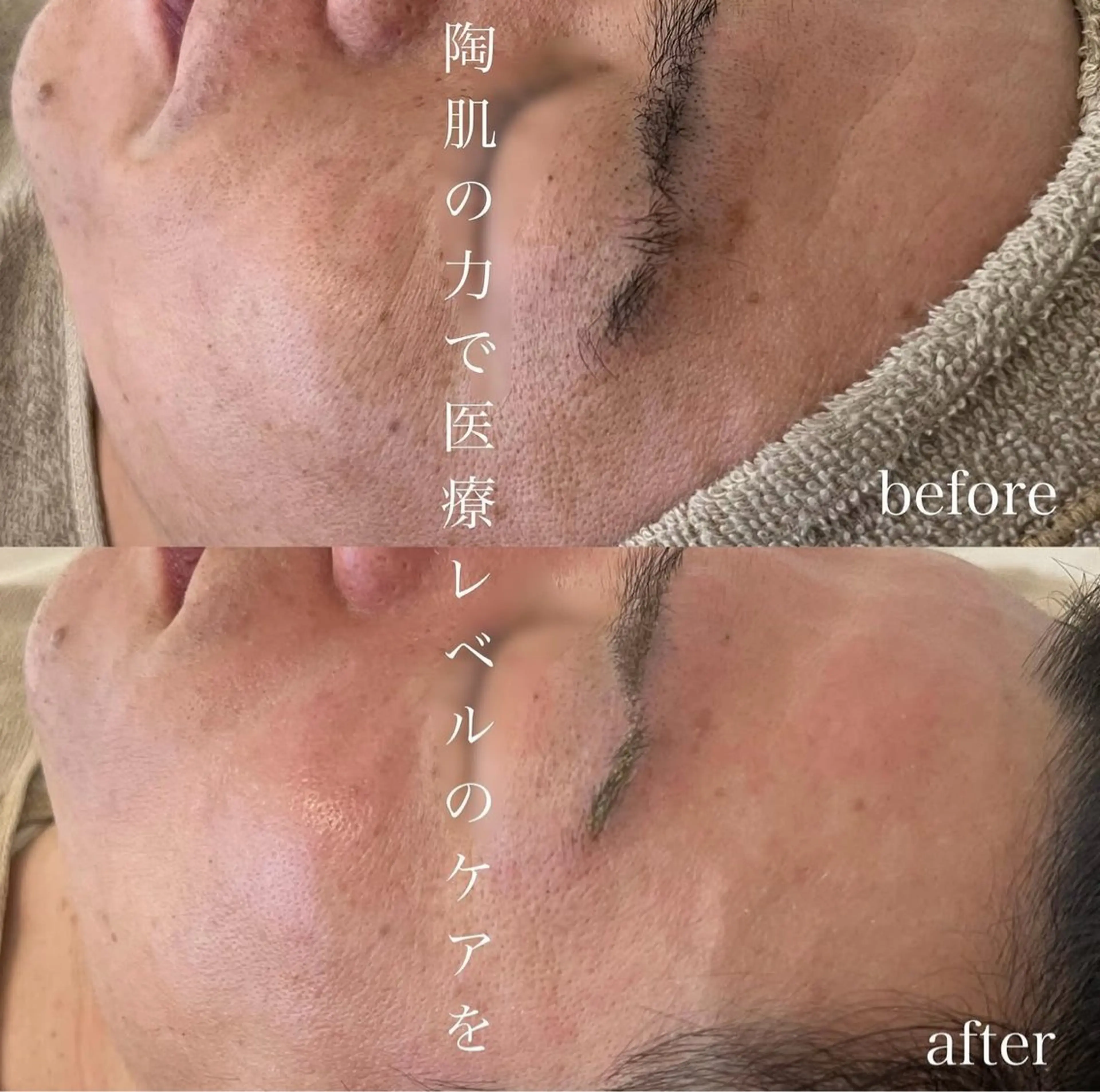 blan. beauty salon所属・blan. /岡本/ 神戸ハーブピーリングのエステ・リラクイメージ