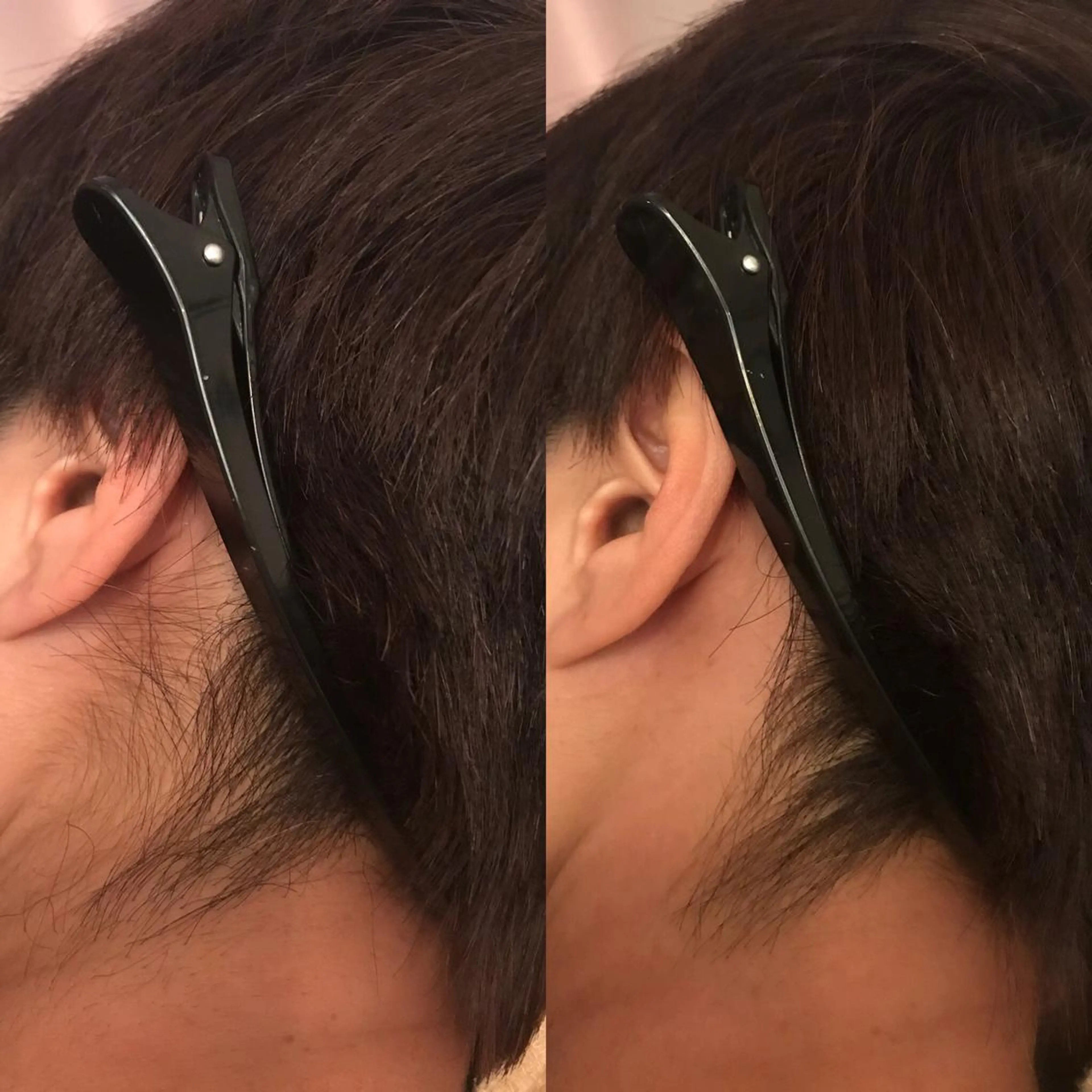 ワックス脱毛 ♡AYO♡のエステ・リラクイメージ