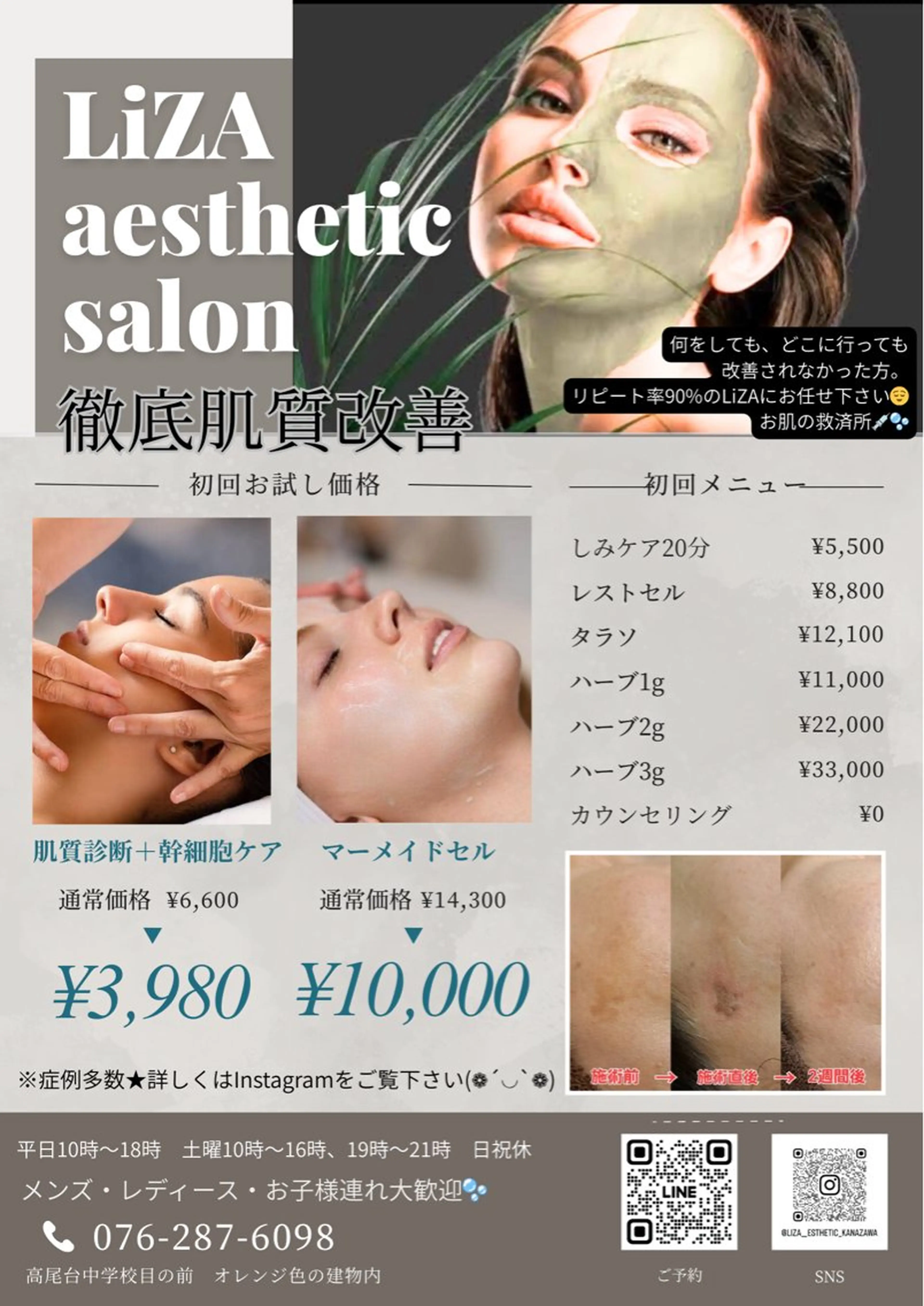 エステ LiZA エステティックサロンのエステ・リラクイメージ