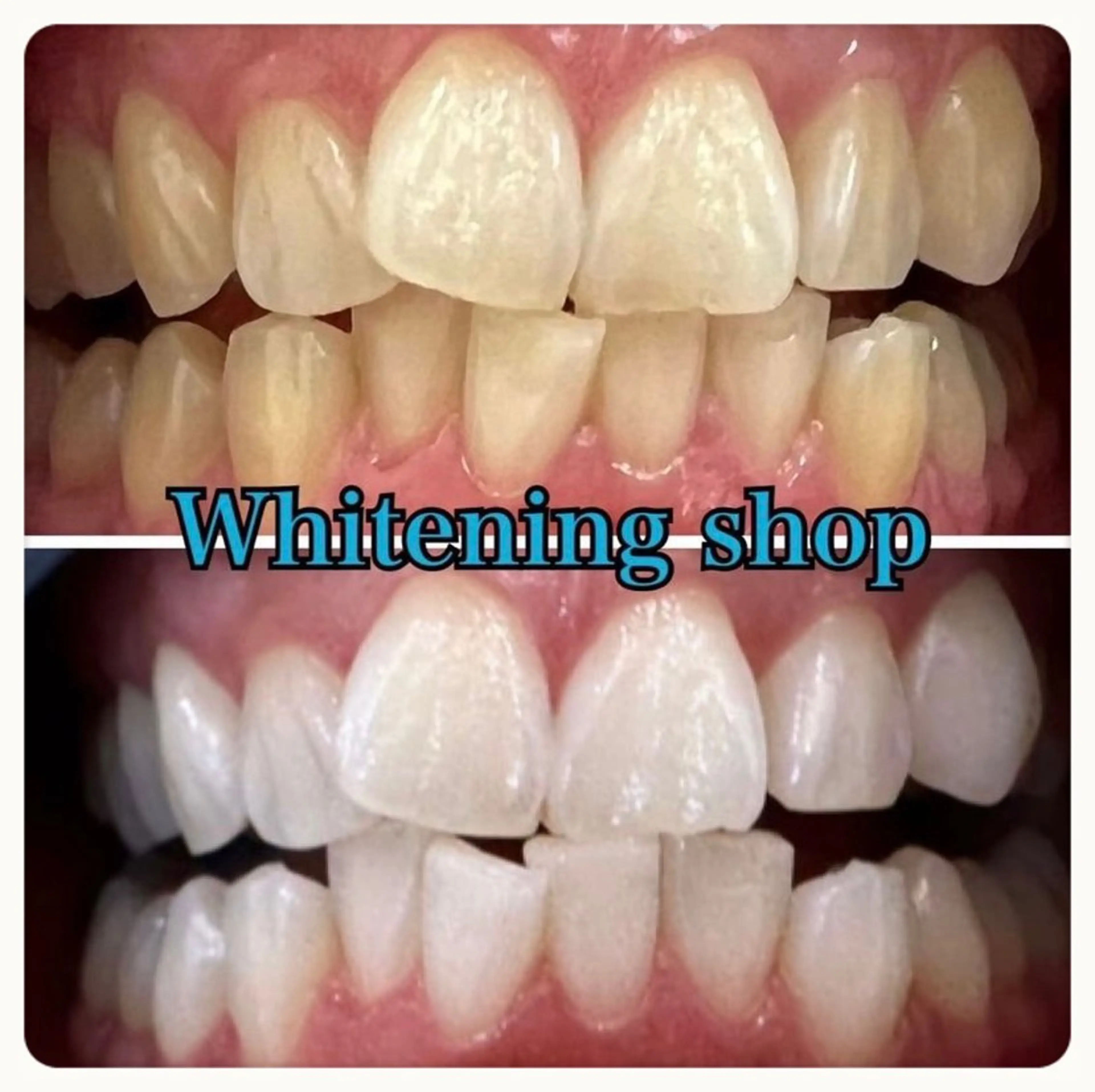 エステ リラク ホワイトニング ショップ吉祥寺店のエステ・リラクイメージ