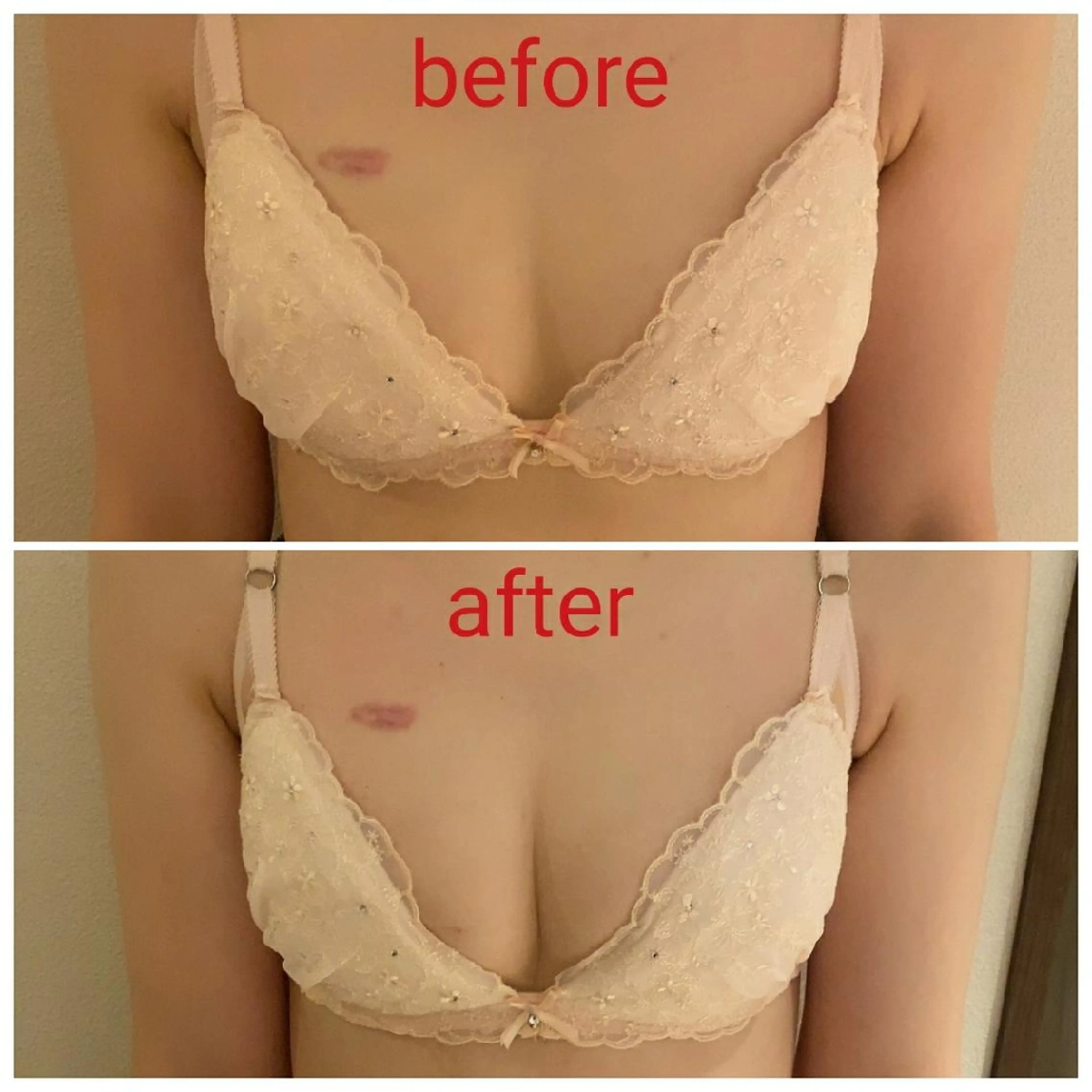 エステ 育乳専門店 Tulipeのエステ・リラクイメージ