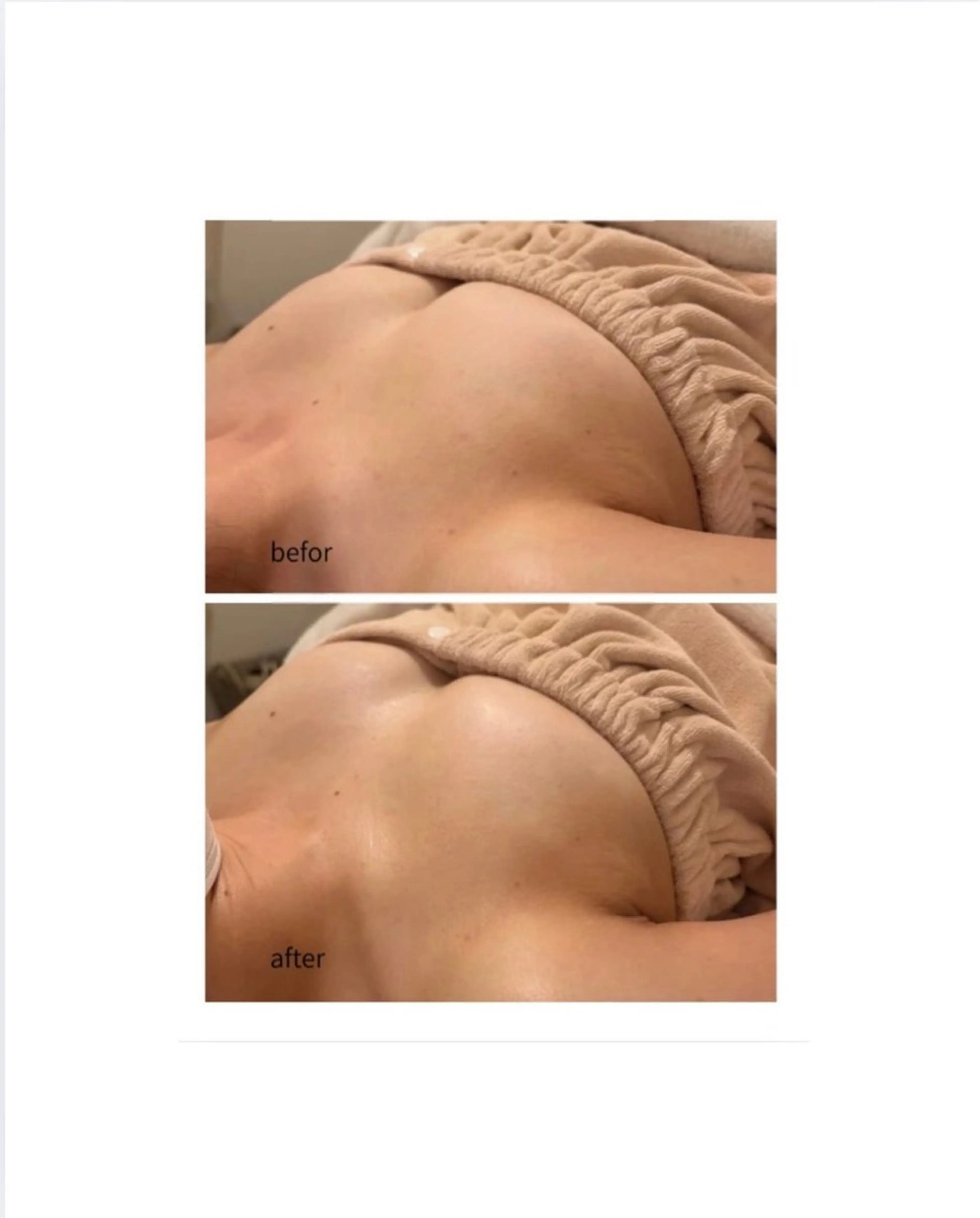 エステ milimili MEGのエステ・リラクイメージ