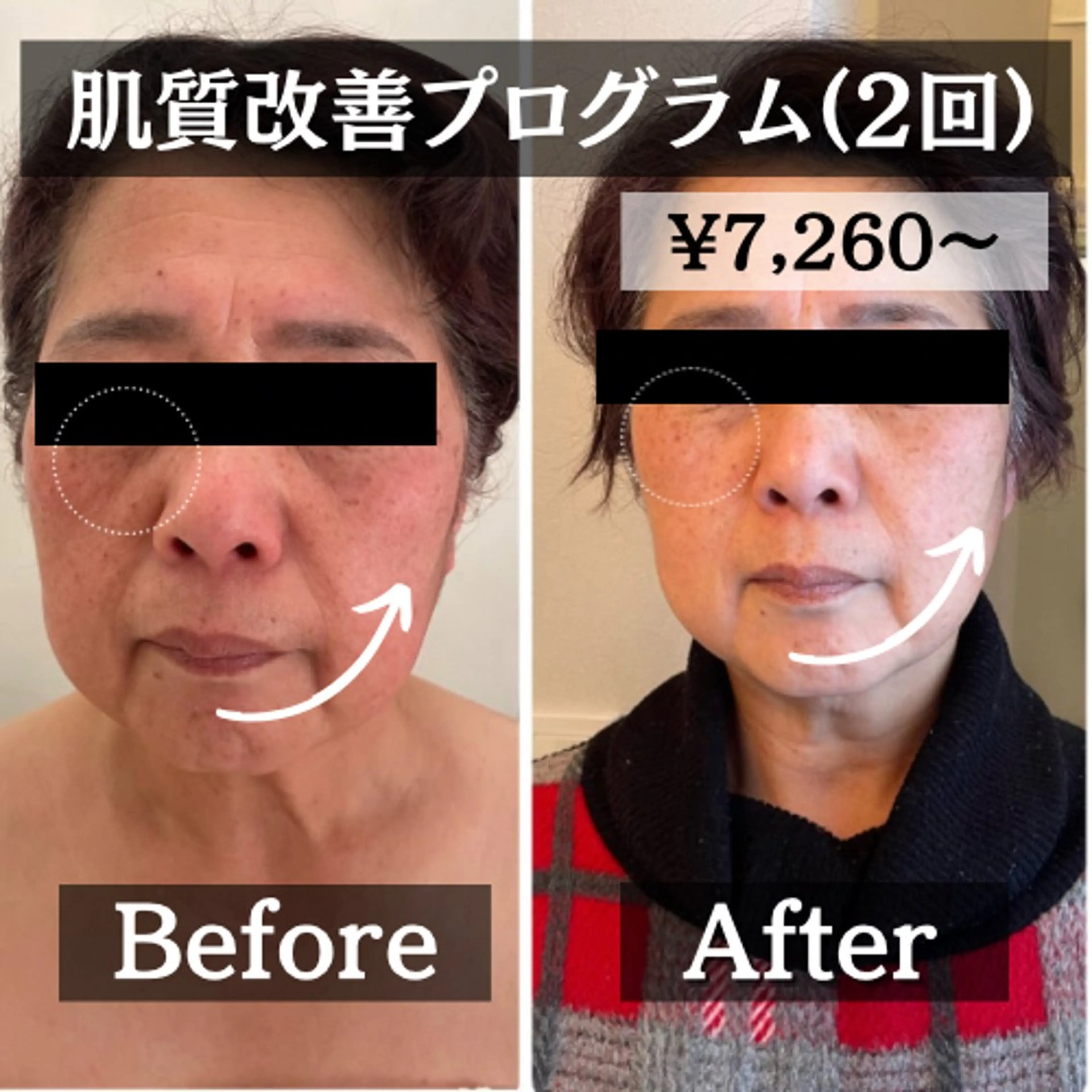 エステ リラク 【肌質改善・リフトアップ専門店】セラピックエステ美極所属・羽賀 茉衣子のエステ・リラクイメージ