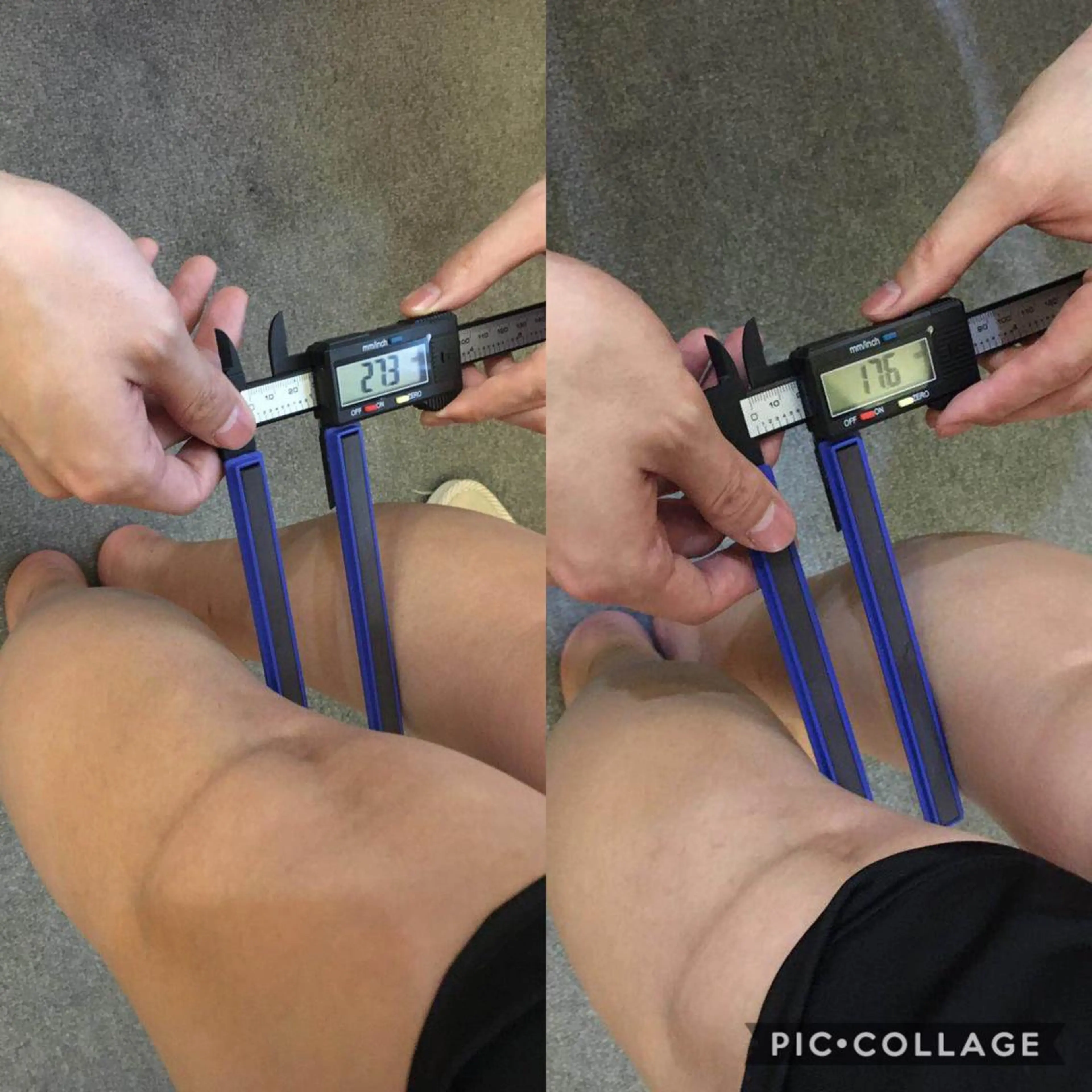 小顔矯正/美容整体 /骨盤矯正✨+Mi2のエステ・リラクイメージ