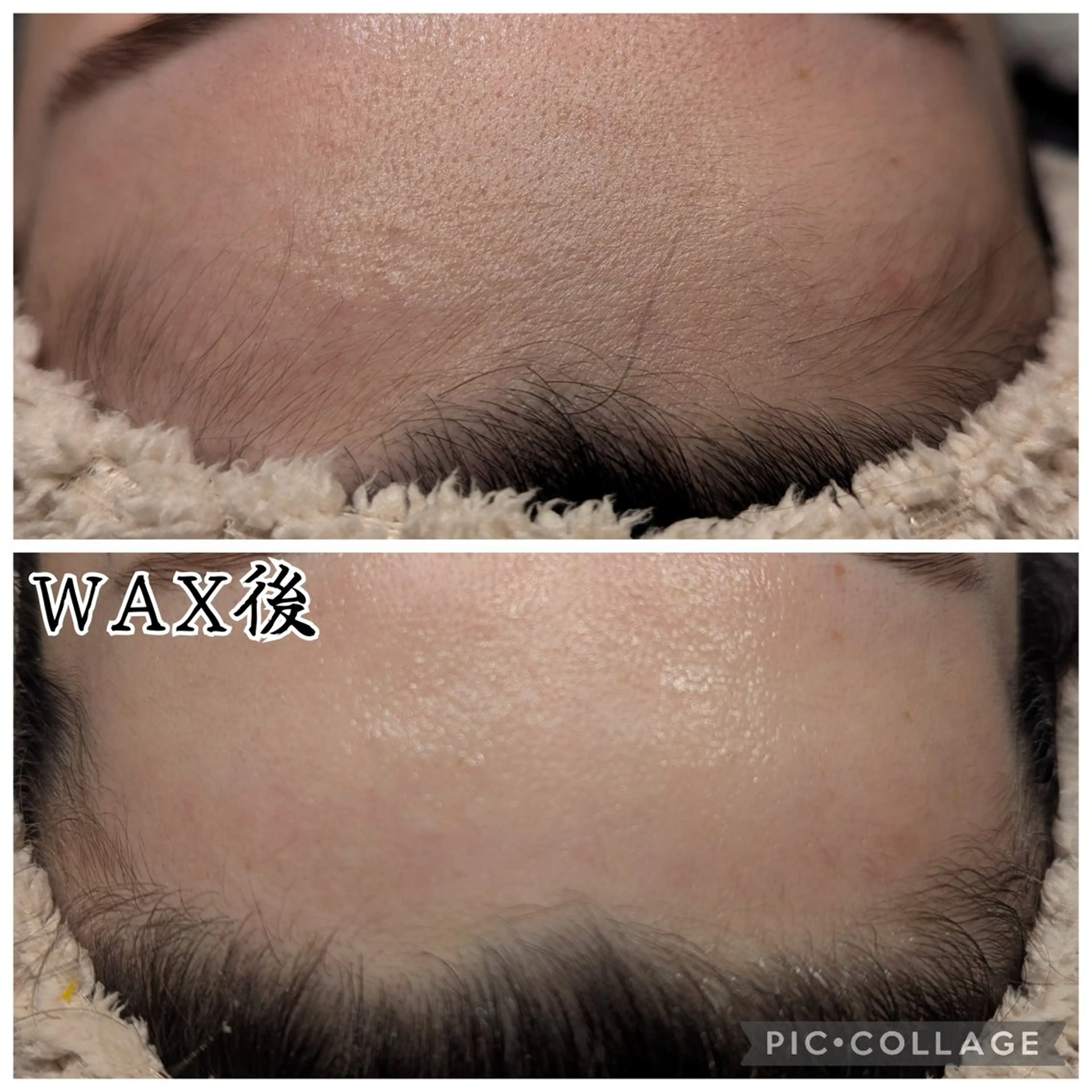 脱毛 肌質改善プライベートサロンwith U所属・肌質改善サロン with Uのエステ・リラクイメージ