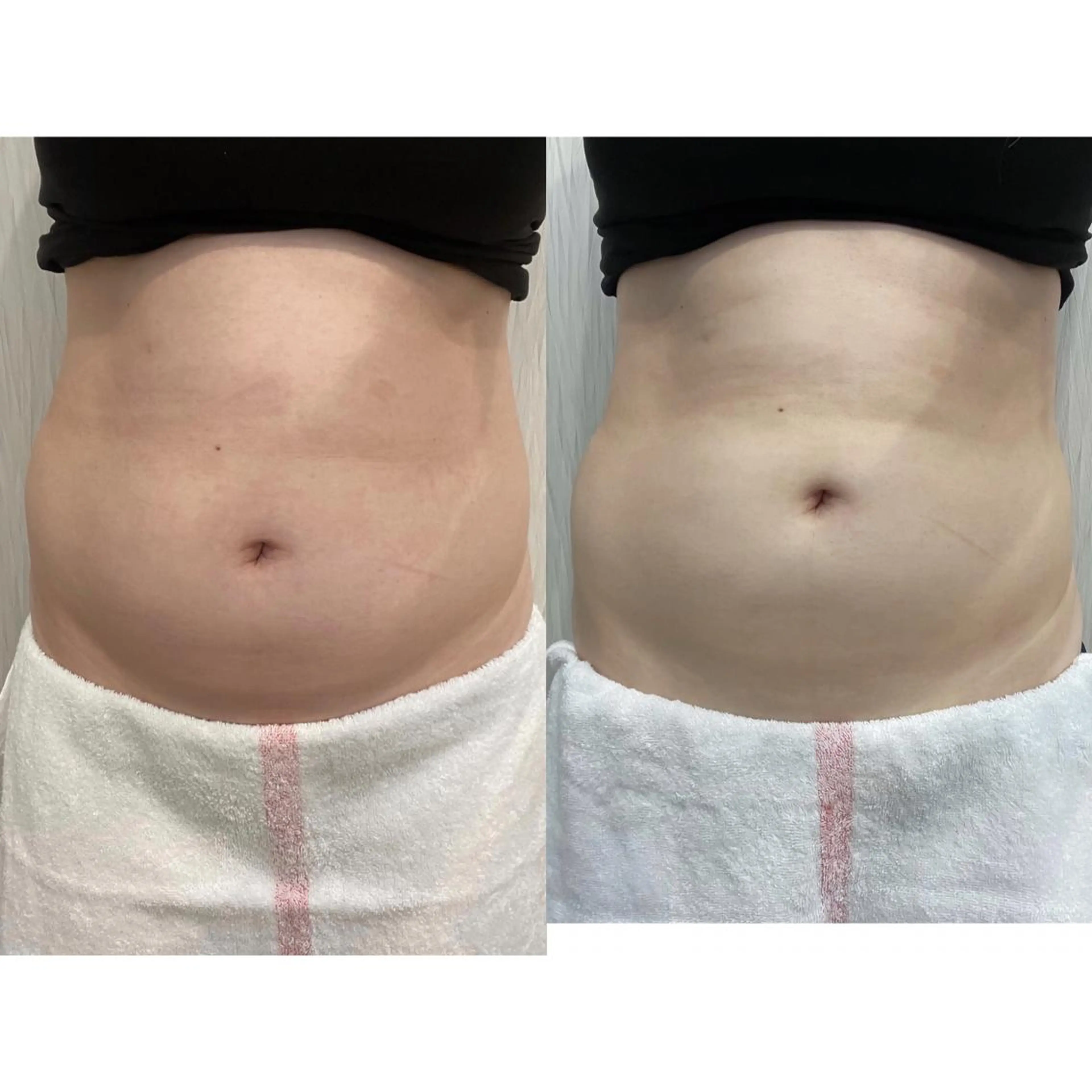 OPREA 千種店のエステ・リラクイメージ