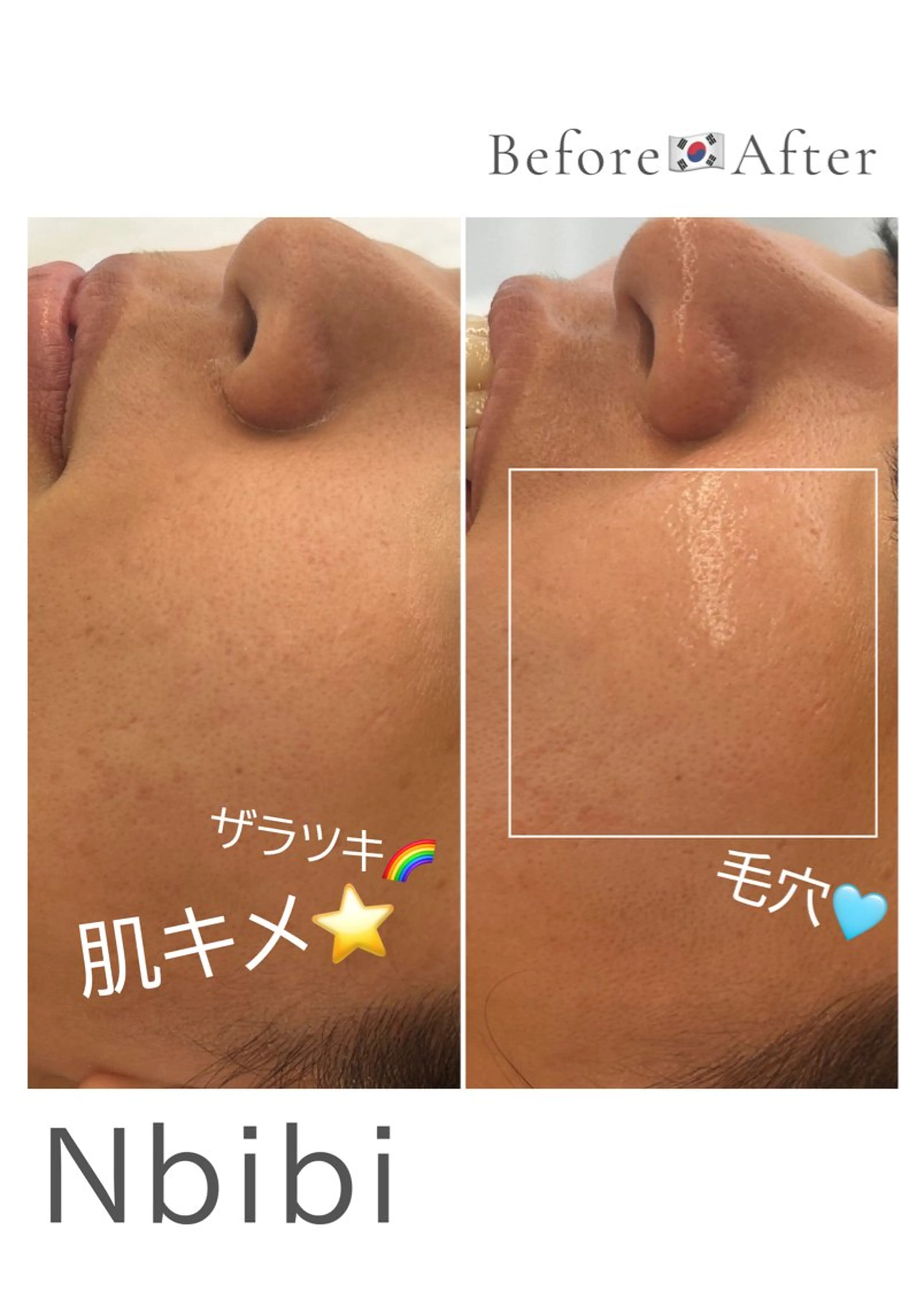 エステ 韓国🇰🇷価格 サロン_Nbibiのエステ・リラクイメージ