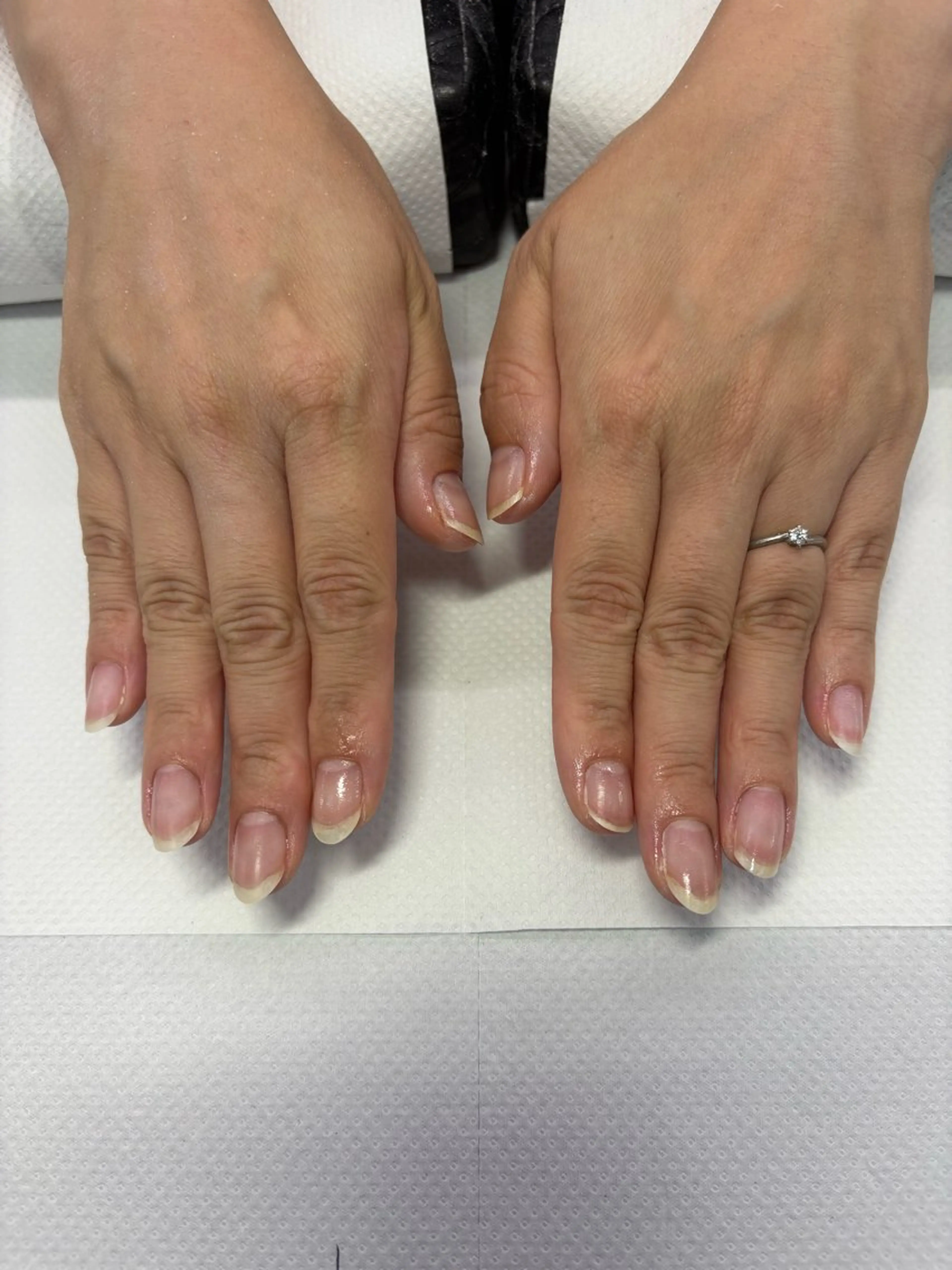 ネイル 楠本 琴音のネイルデザイン