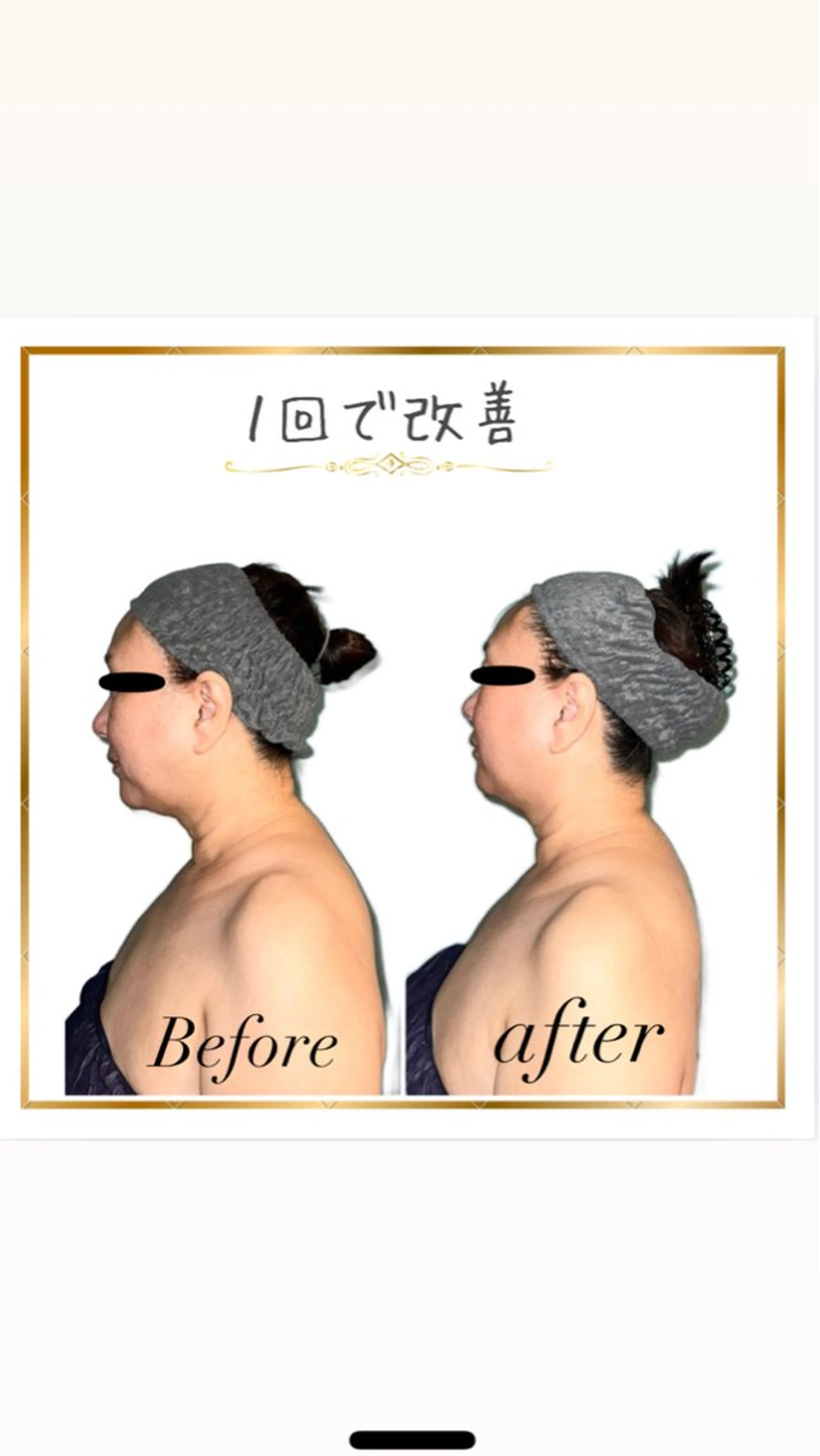 3名様限定【ストレートネック根本ケア】辛い慢性的な首肩こり、巻き肩、腕の捻れを解消するスペシャルケアの写真