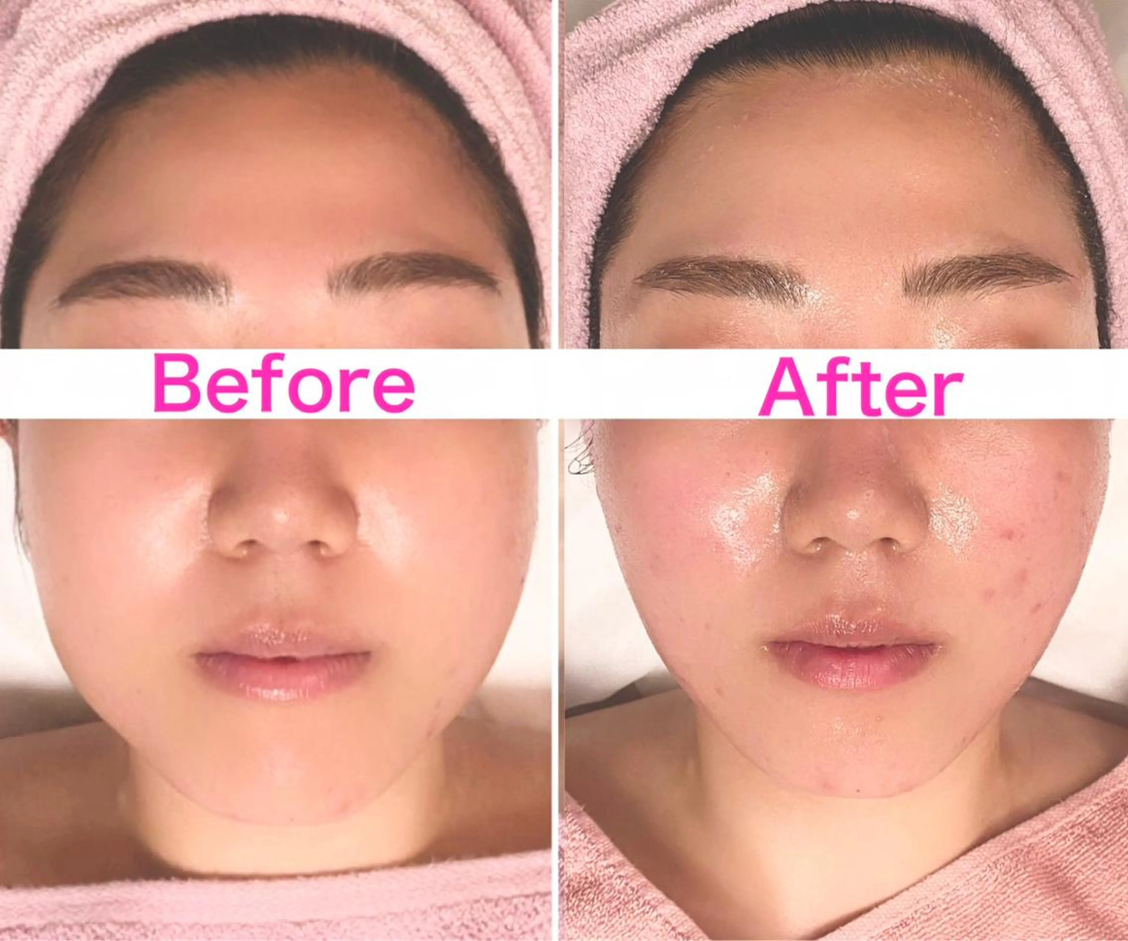 綺麗のひみつ グランプリ受賞店のエステ・リラクイメージ