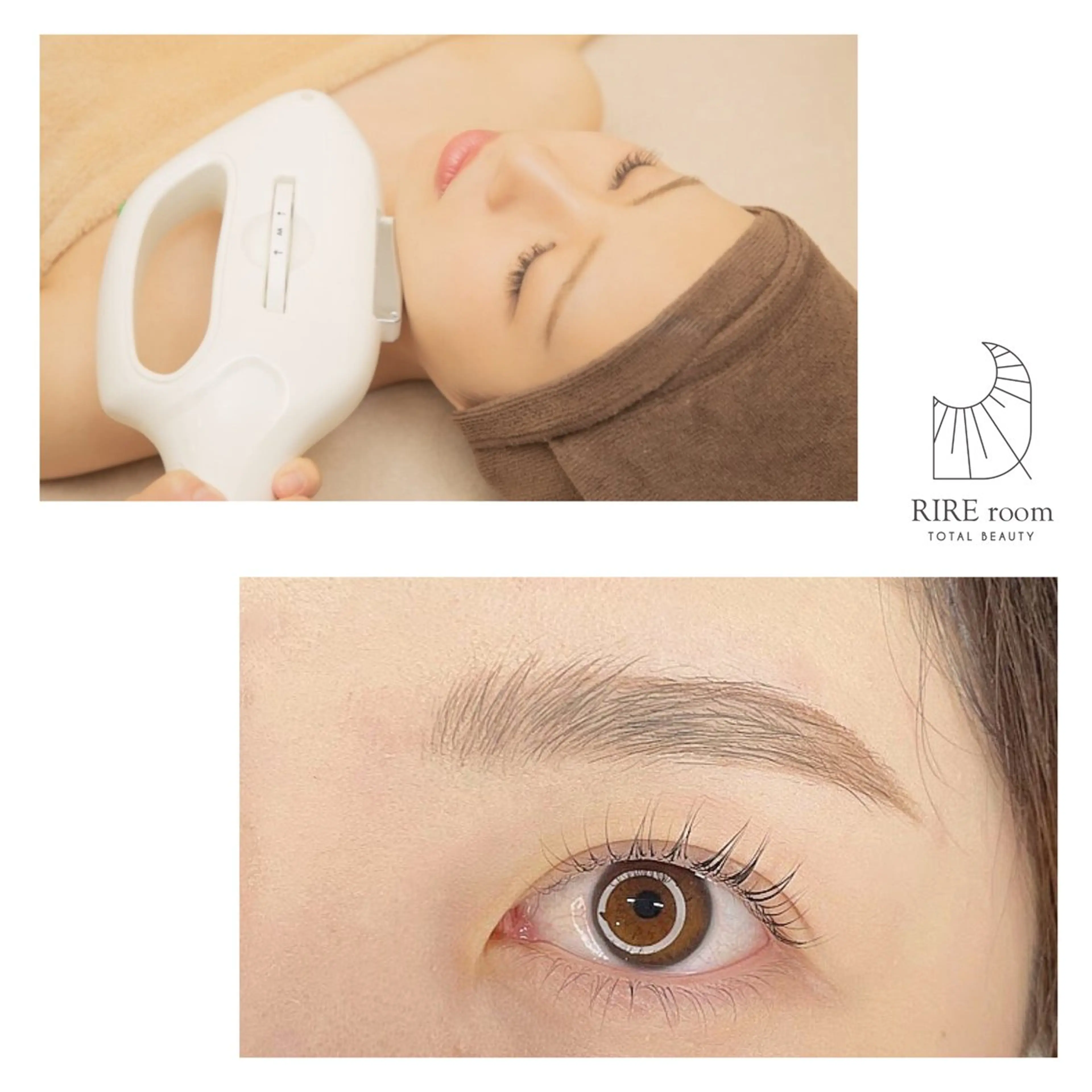 【人気セット】お顔脱毛×ハリウッドブロウリフト ¥10500の写真