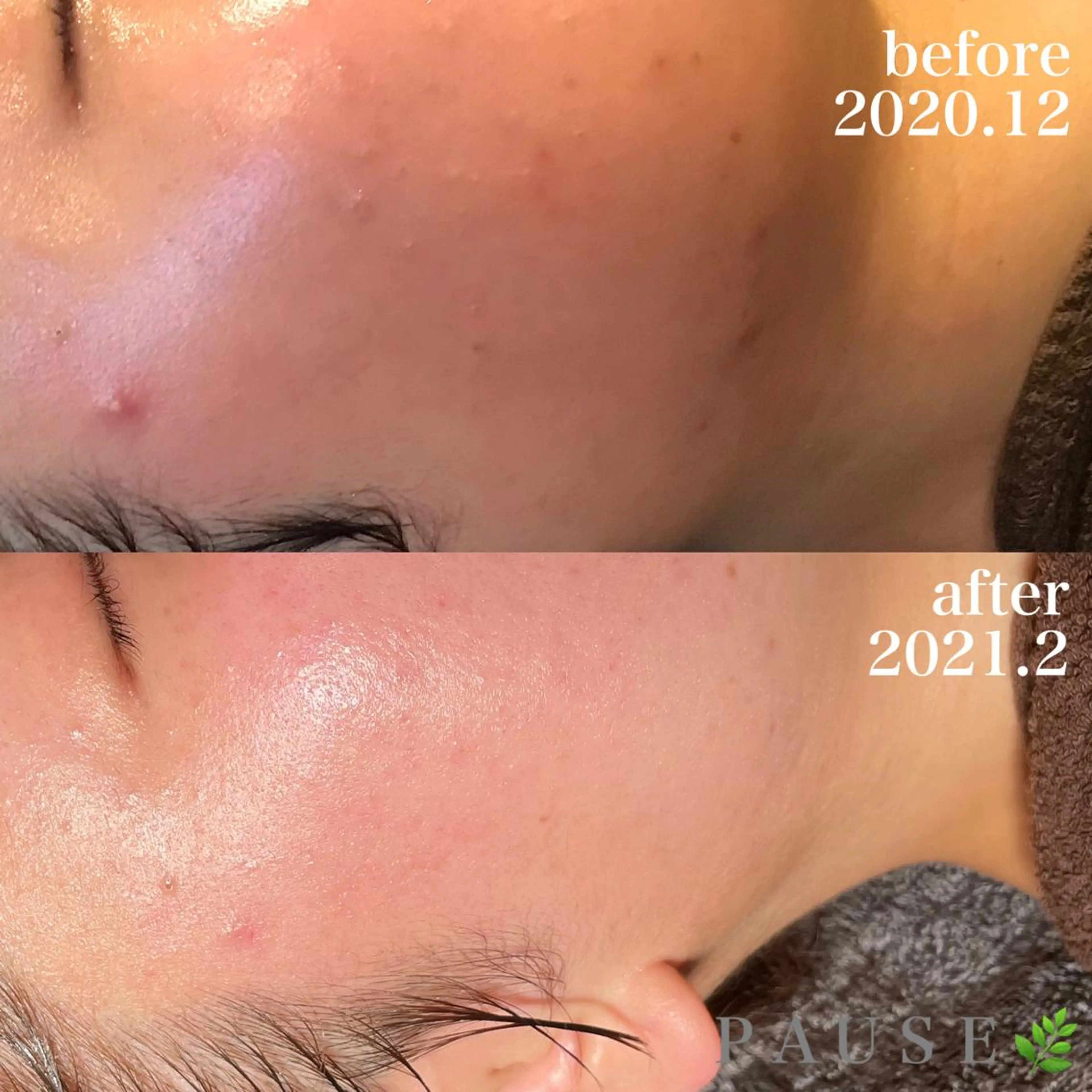 エステ 浜野 恵美のエステ・リラクイメージ