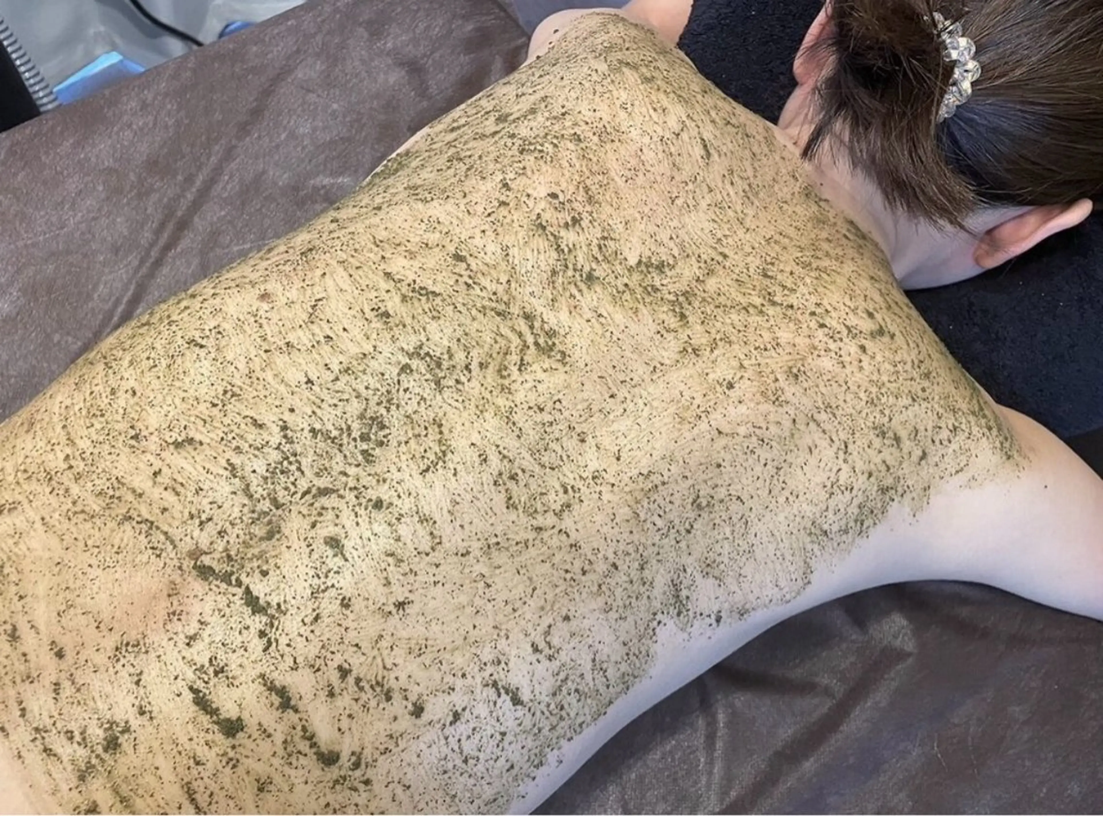 【見えるところの集中ケア★】背中上部の剥離なしハーブピーリングの写真