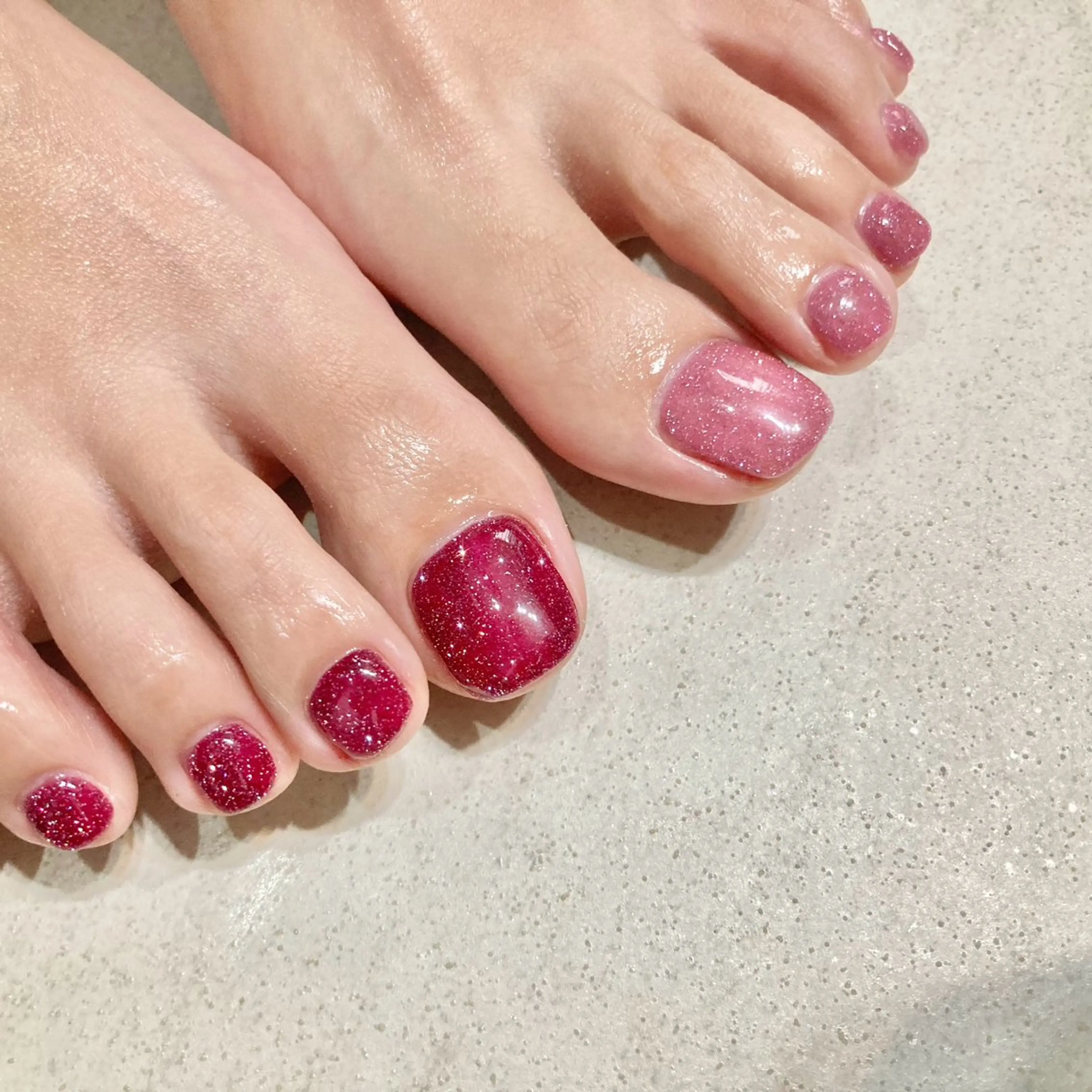 フットシンプルプランの写真