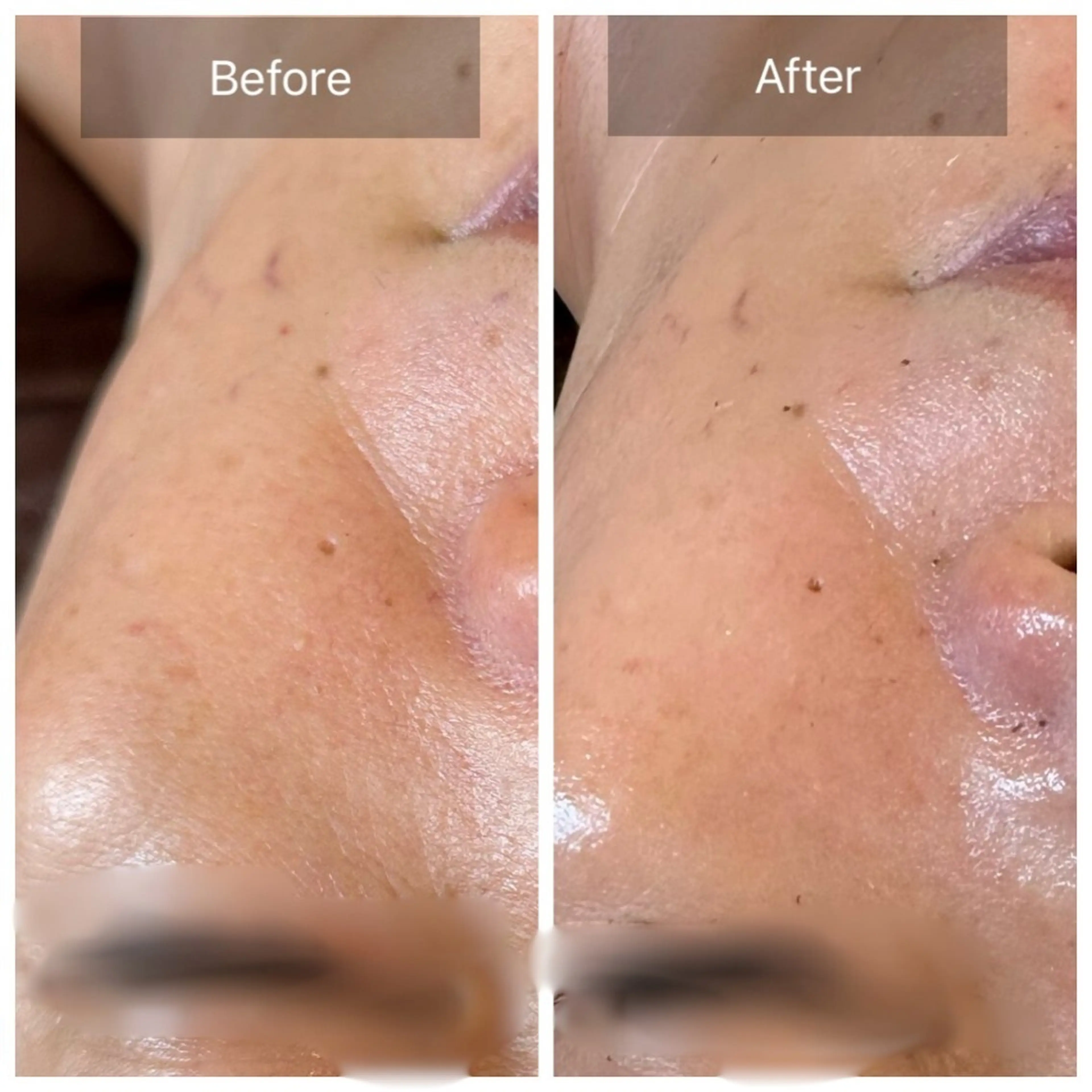 Nicore所属・Nicore NATSUKIのエステ・リラクイメージ