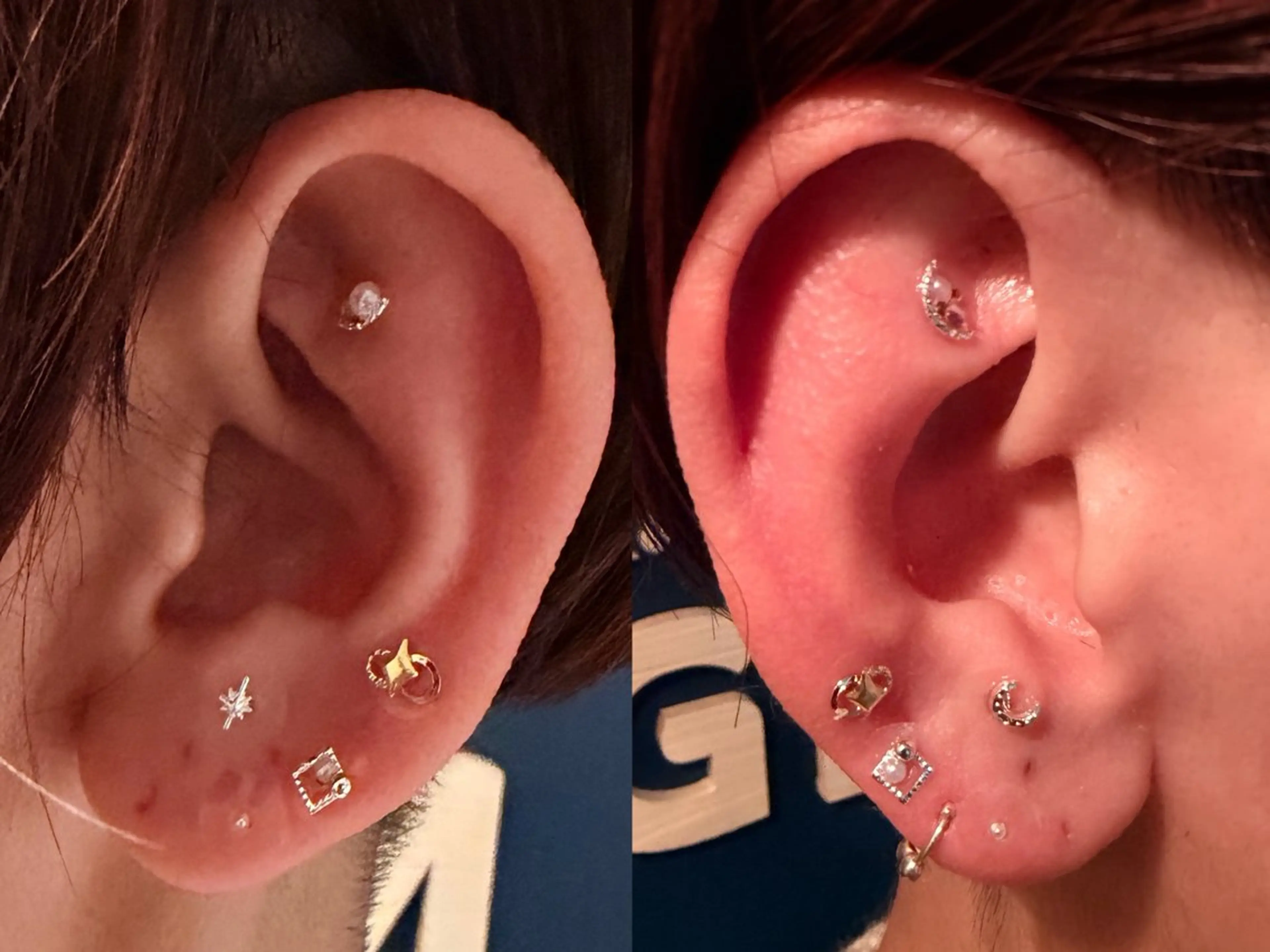 リラク x8em _kのエステ・リラクイメージ