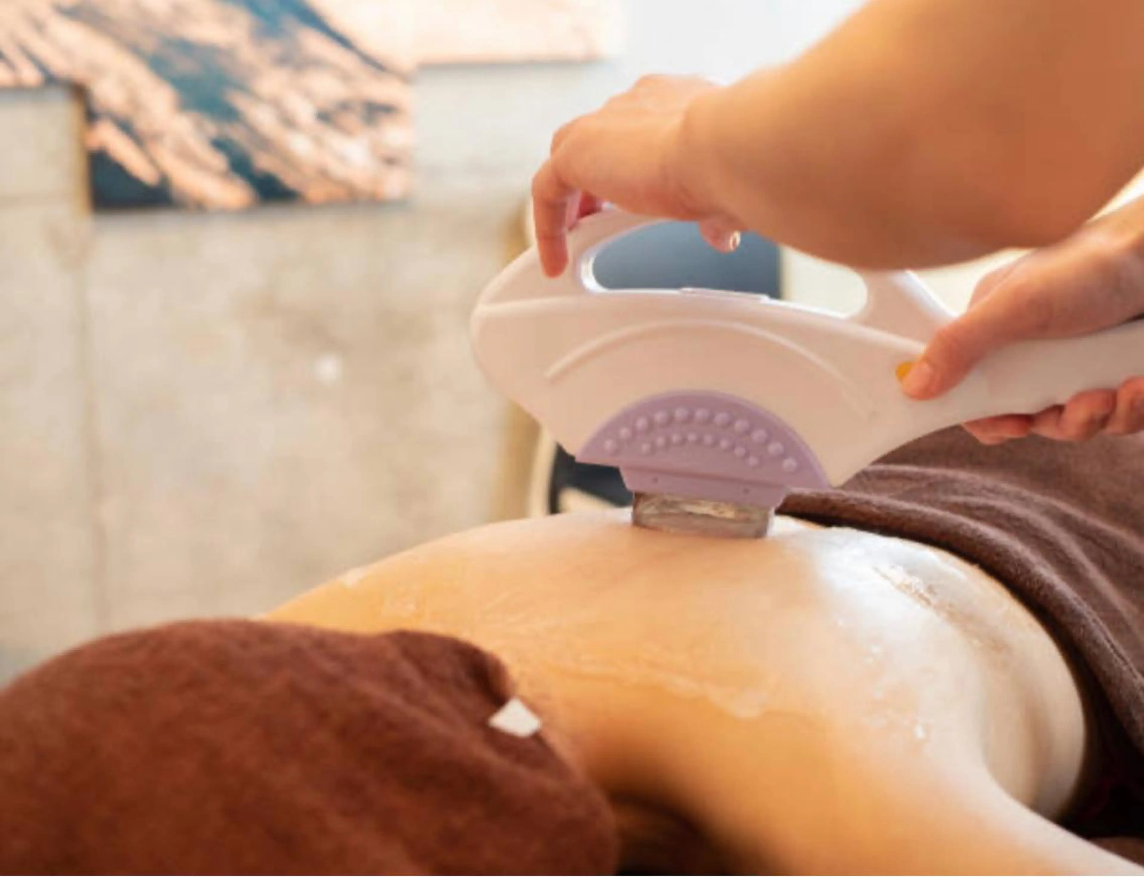 【最新美肌脱毛】全身(顔VIOなし)の写真