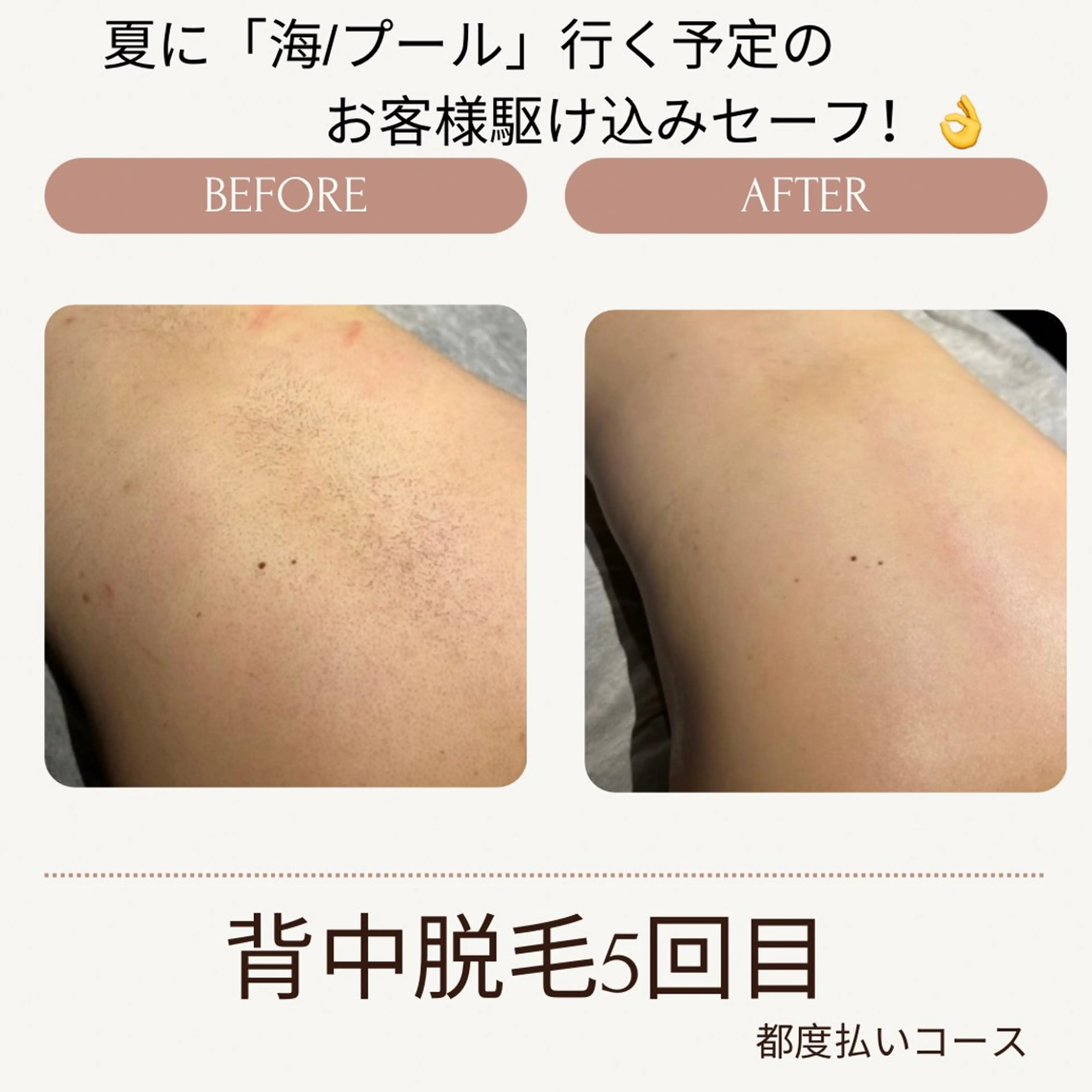 VANILLA SKY所属・VANILLA SKYのエステ・リラクイメージ