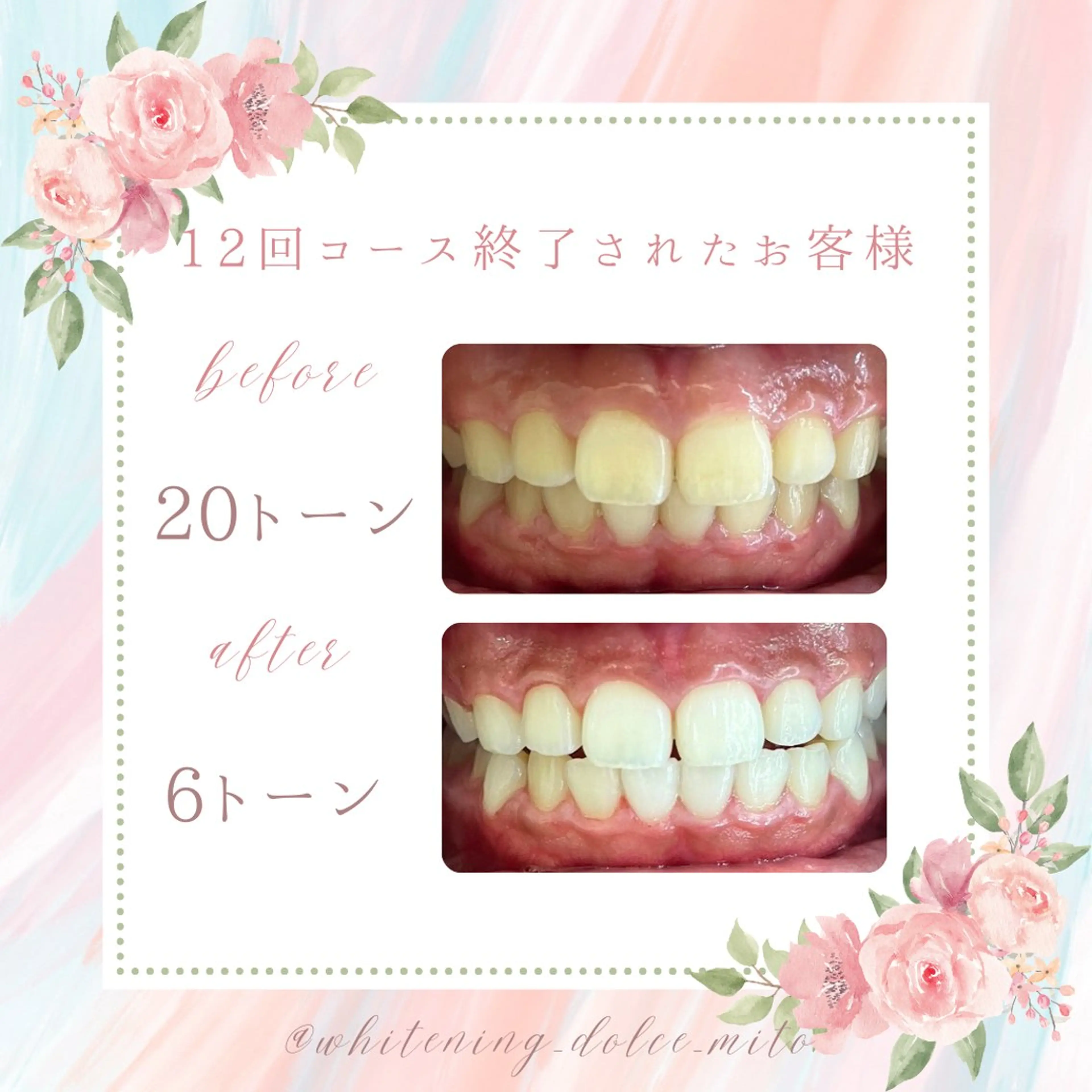 セルフホワイトニング Dolce水戸店のその他イメージ