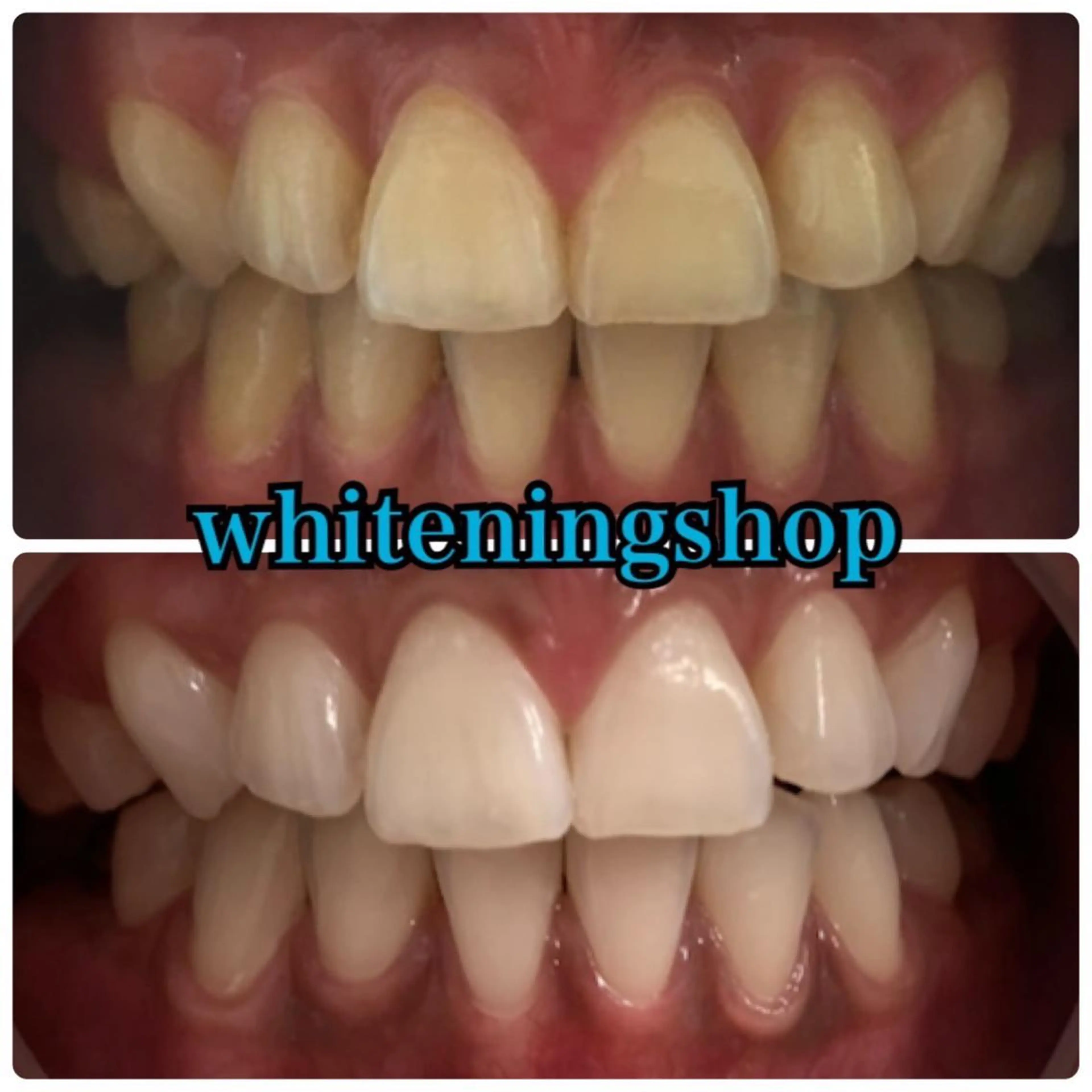 その他 ホワイトニングショップ金沢所属・ホワイトニング ショップ金沢のその他イメージ