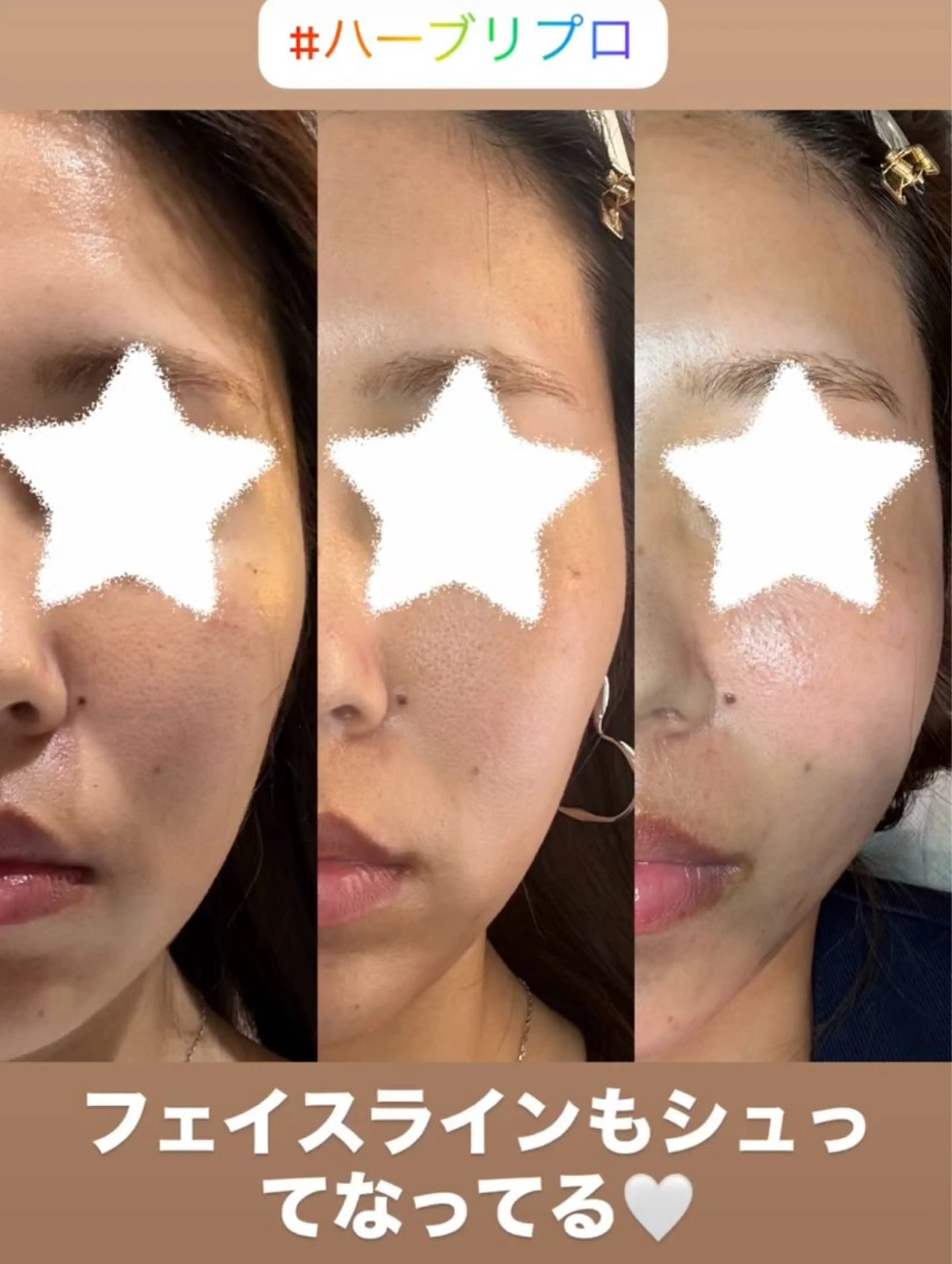 エステ EstheticSalonReTweet所属・竹谷 春希のエステ・リラクイメージ