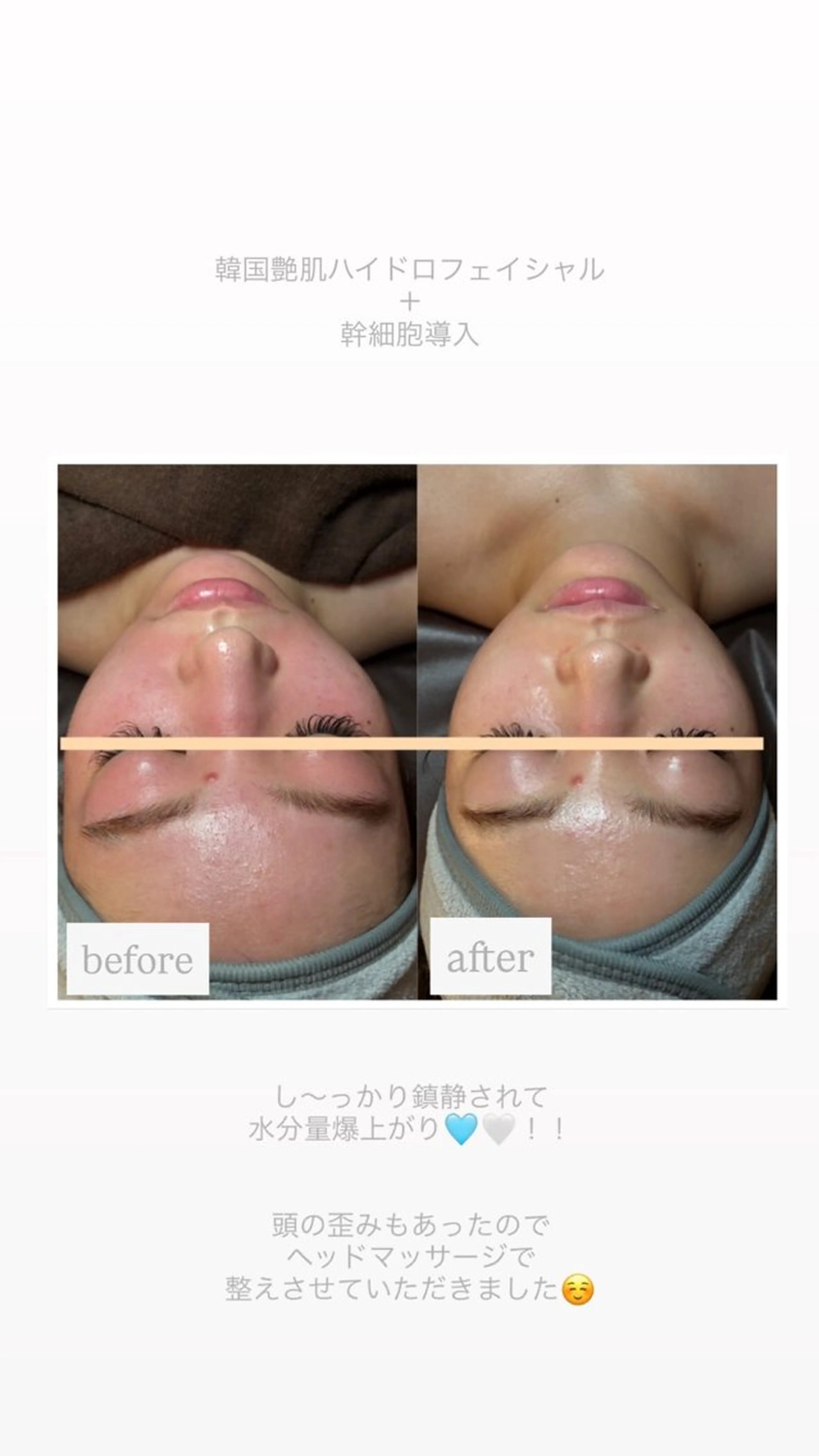 chouchou【シュシュ】所属・トータルボディケア chouchouのエステ・リラクイメージ