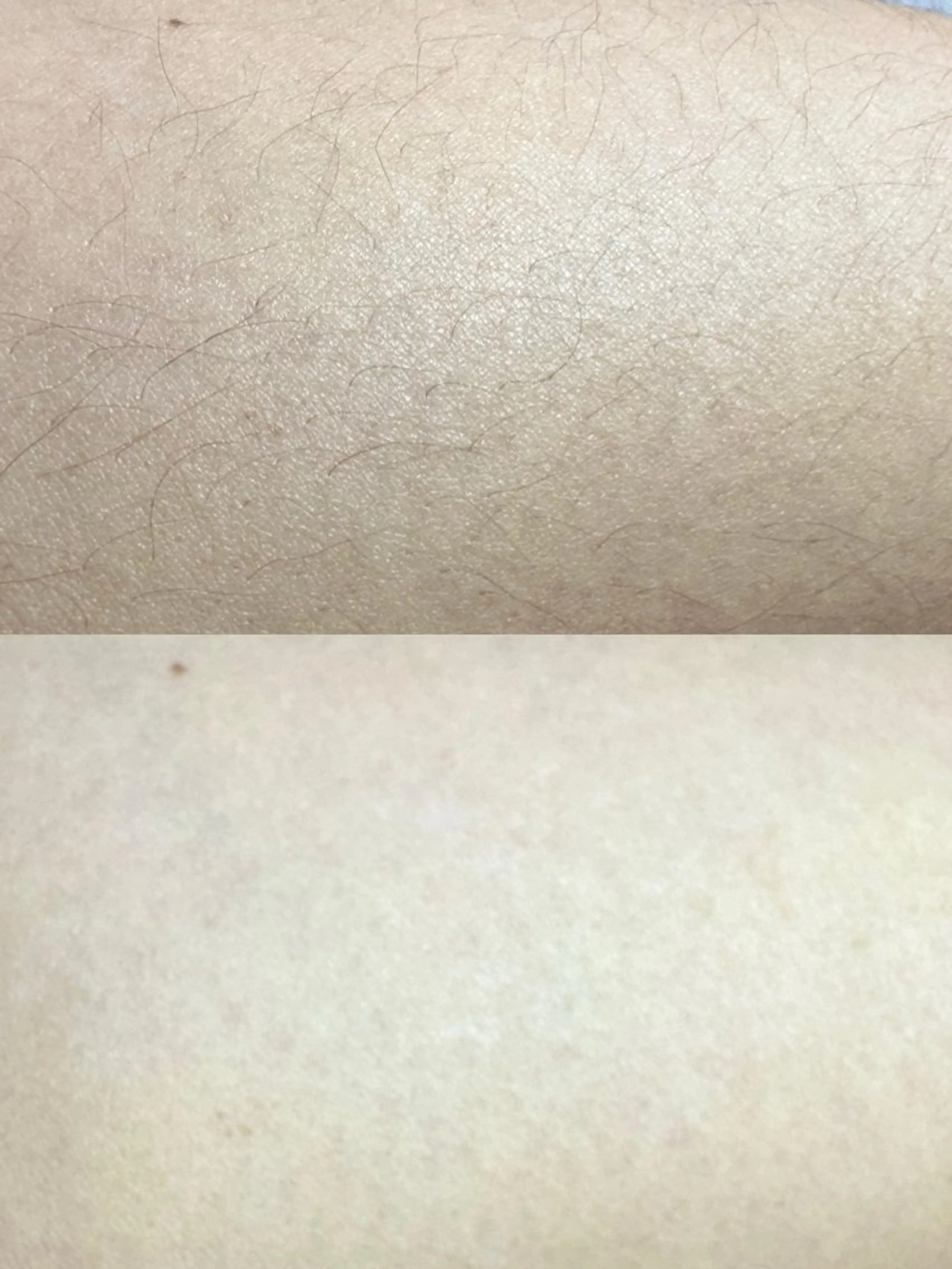 Hit. シュガーリング豊橋のエステ・リラクイメージ