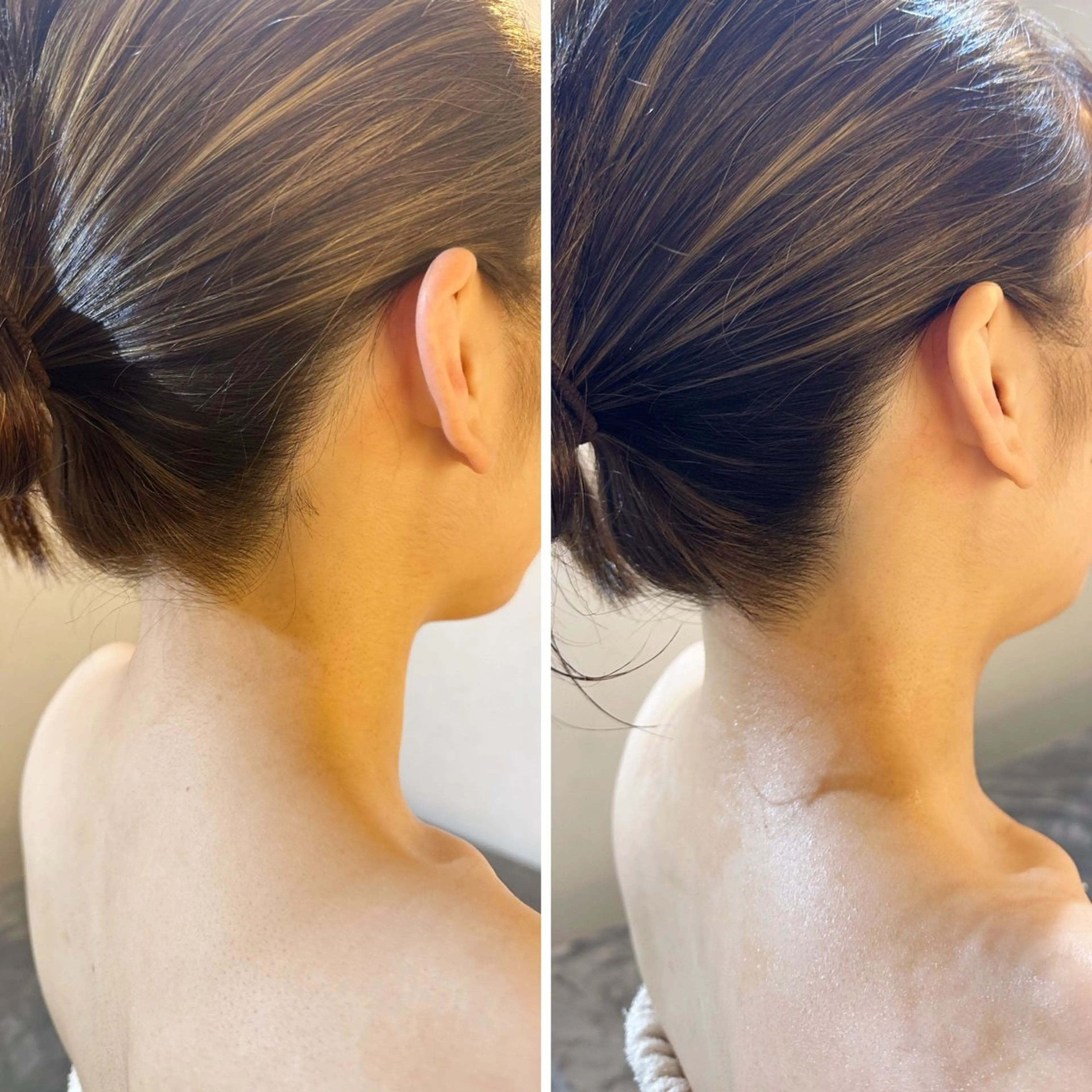 脱毛 うなじ脱毛/美肌脱毛 LABELのエステ・リラクイメージ