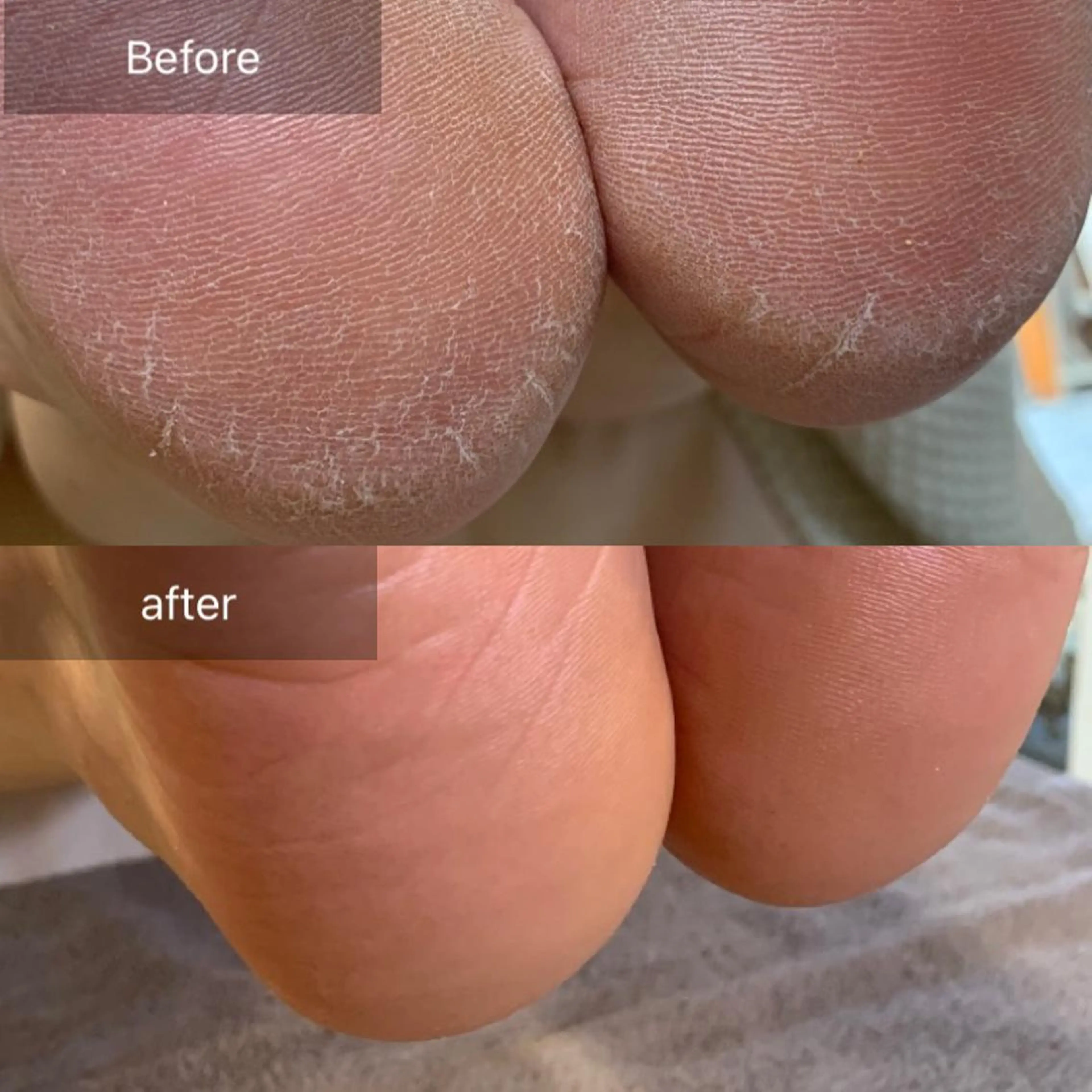 今からケアしたい💨💨カチカチかかと！フット角質ケア＋ Aromaマッサージの写真